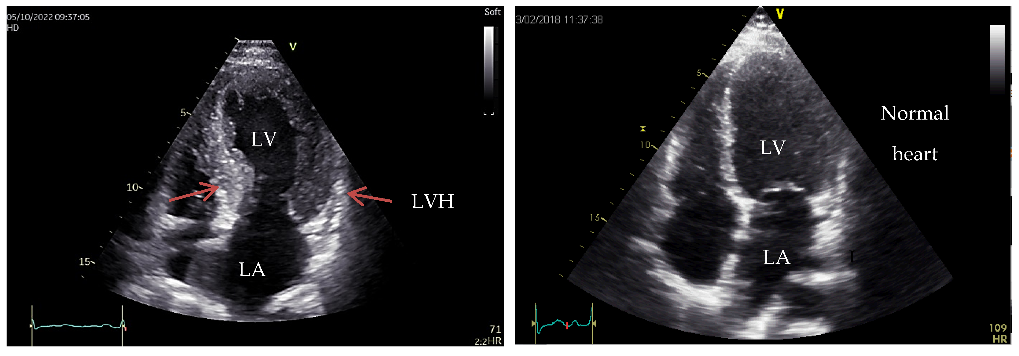 Medicina 60 00543 g001 Medicina 60 00543 g001