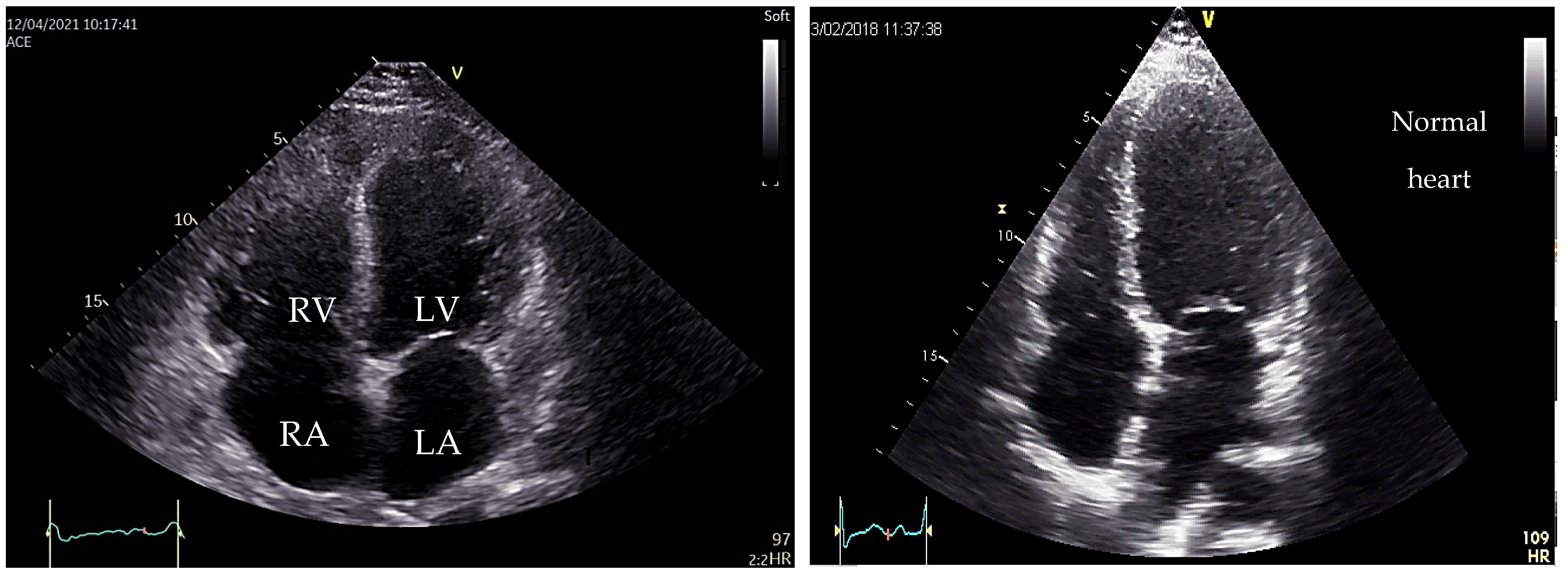 Medicina 60 00543 g003 Medicina 60 00543 g003