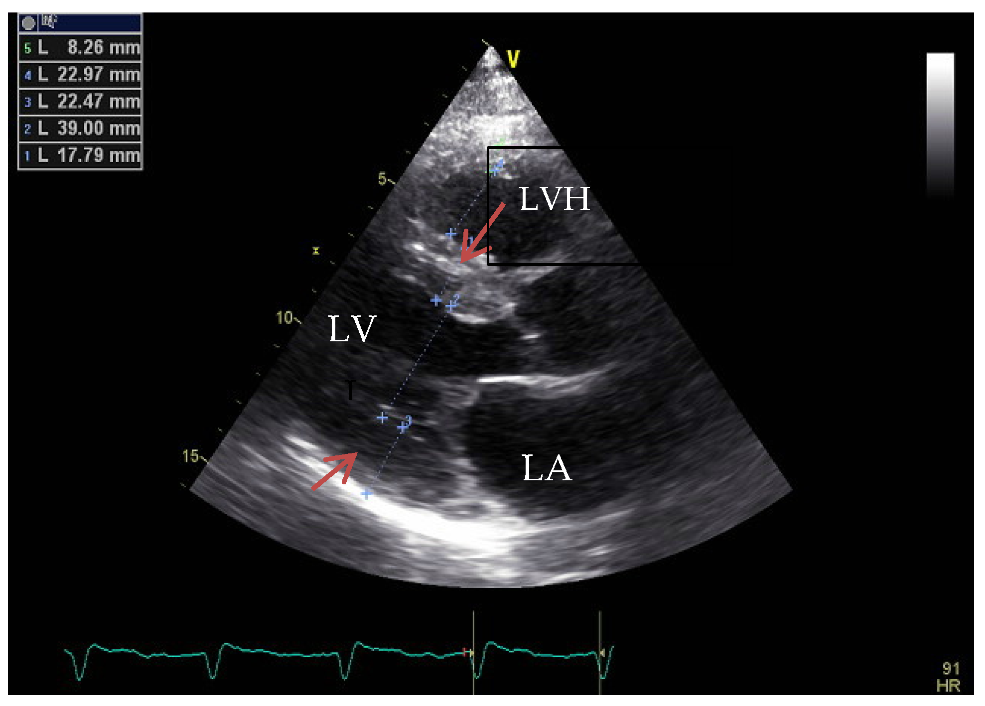 Medicina 60 00543 g005 Medicina 60 00543 g005