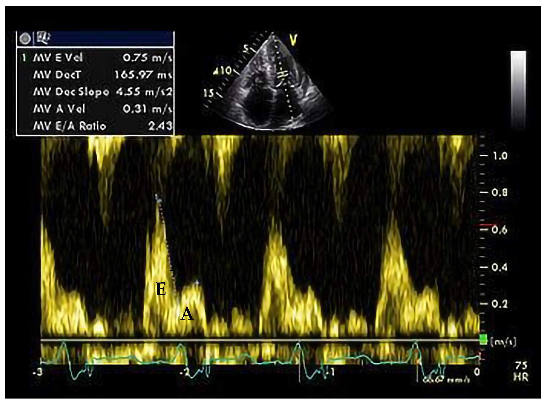 Medicina 60 00543 g006 Medicina 60 00543 g006
