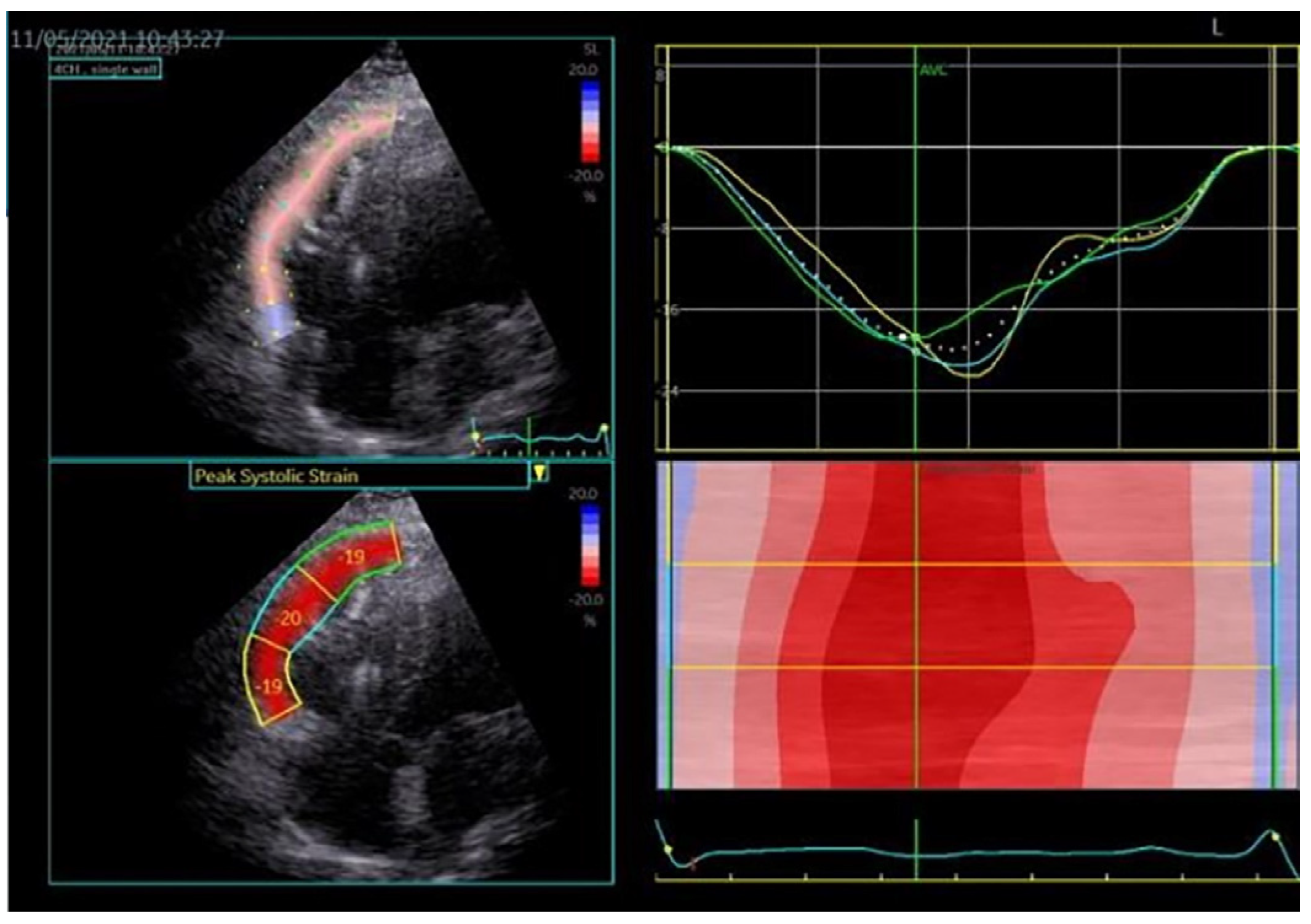 Medicina 60 00543 g008 Medicina 60 00543 g008