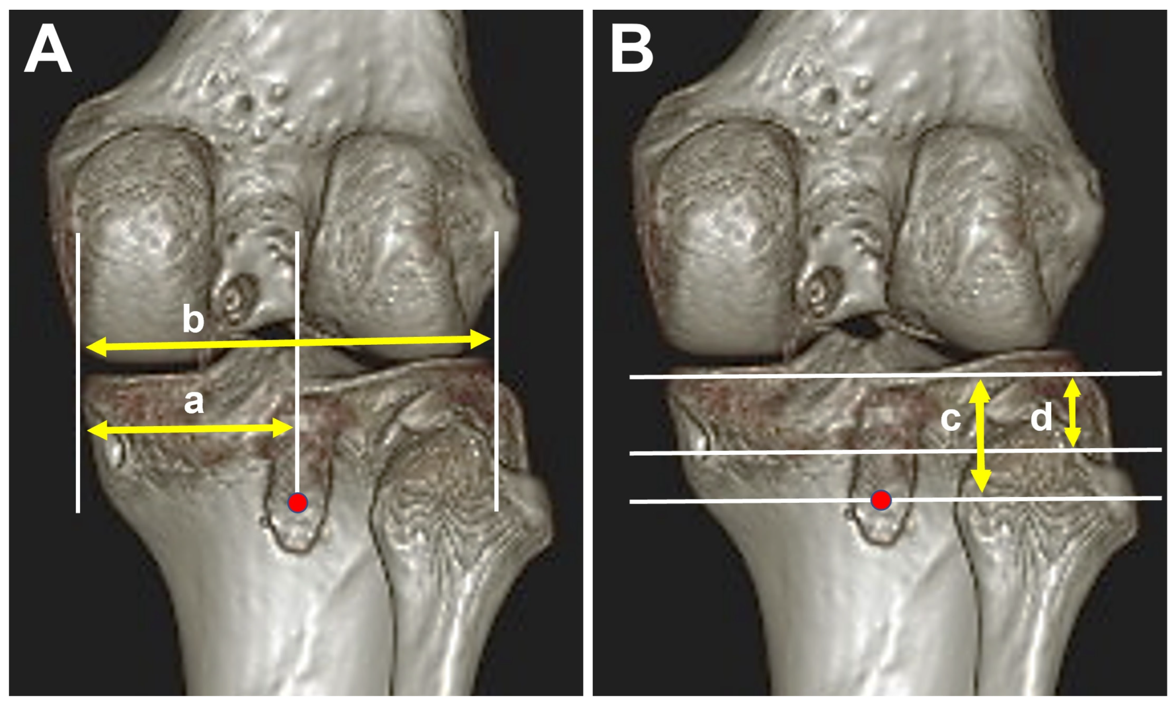 Medicina 60 00545 g004