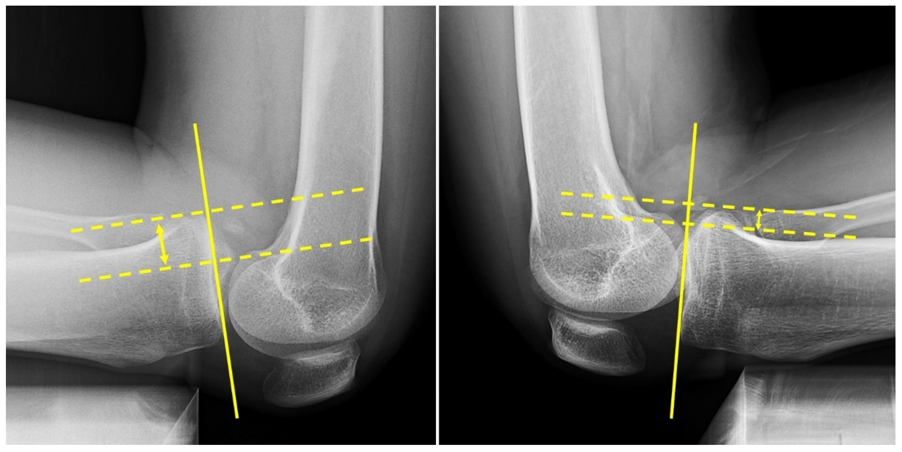 Medicina 60 00545 g005