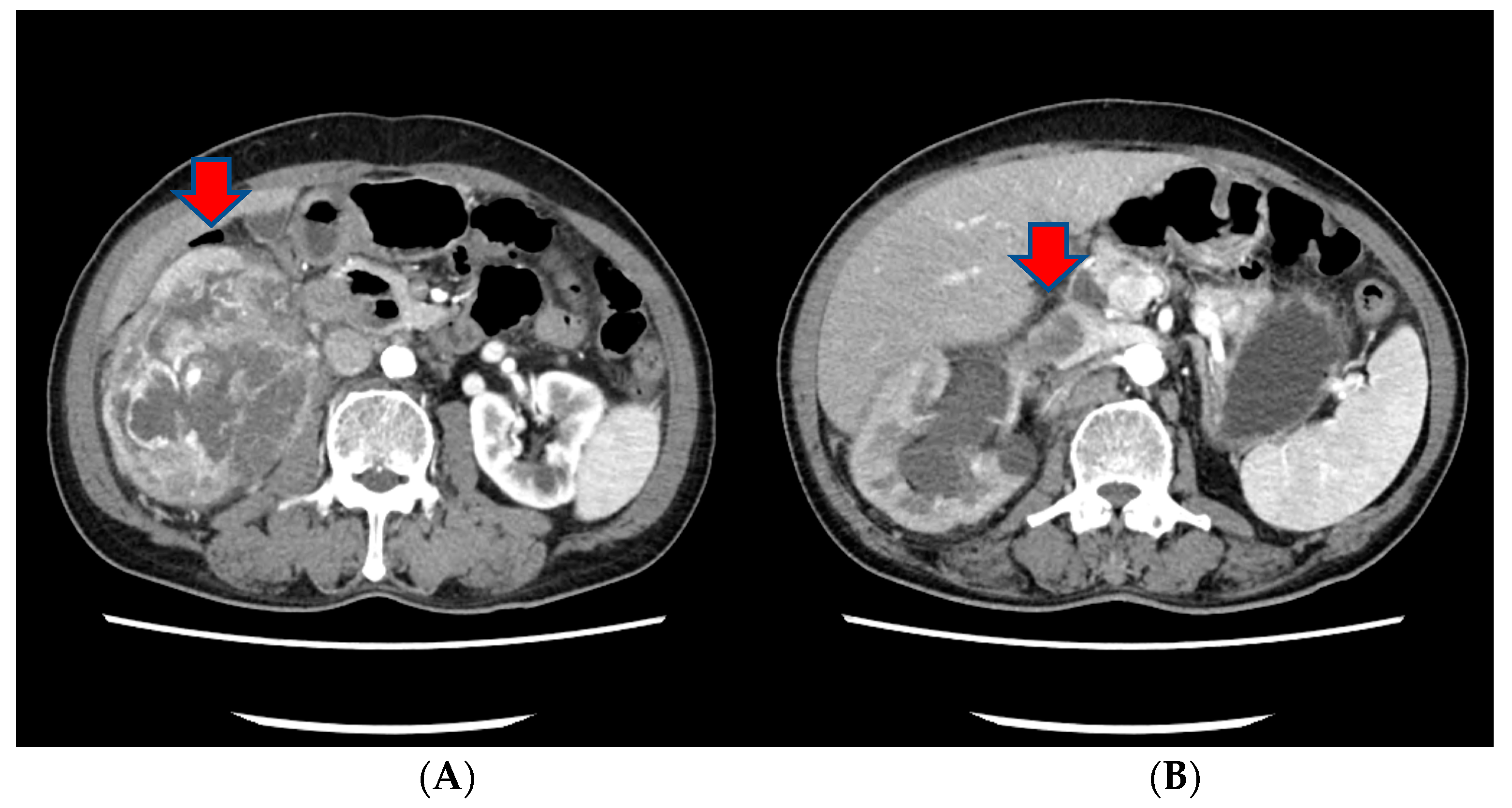 Medicina 60 00554 g001