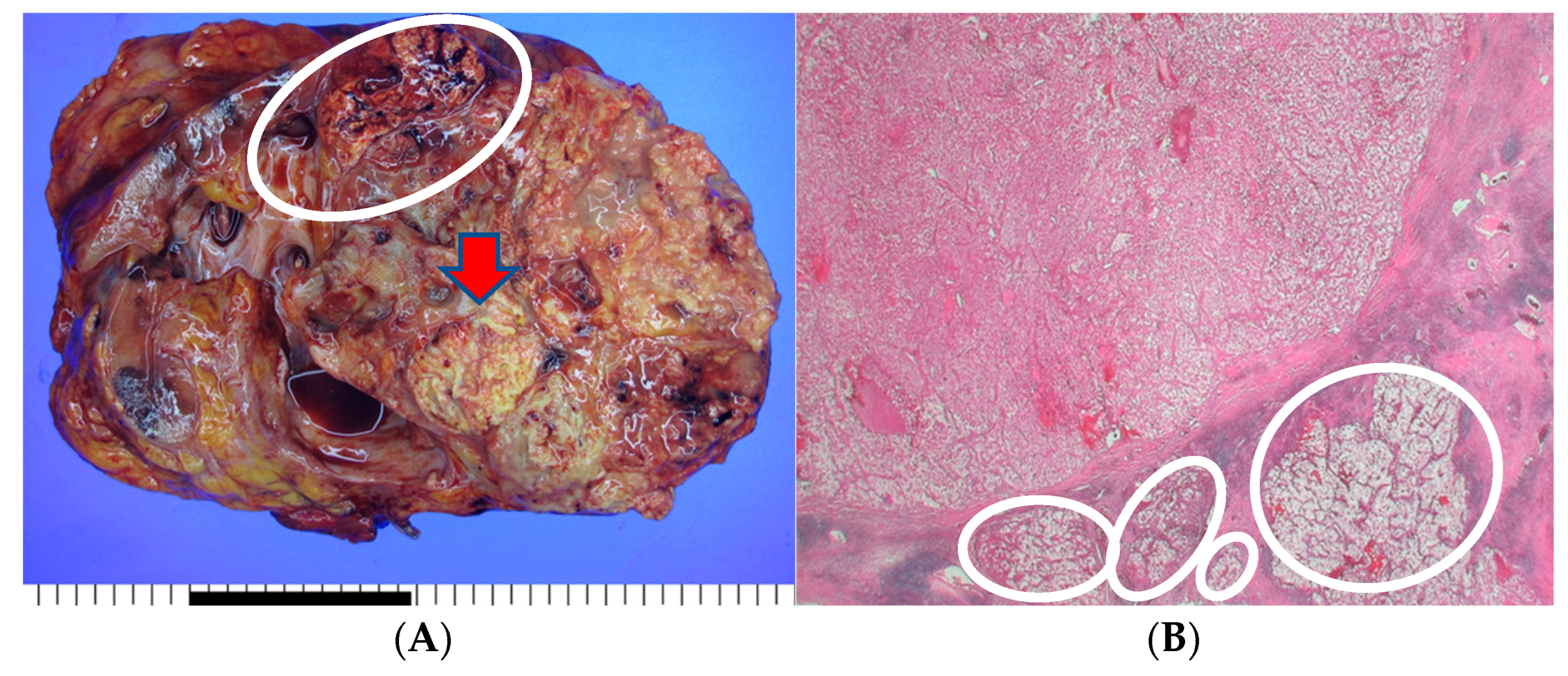 Medicina 60 00554 g002a