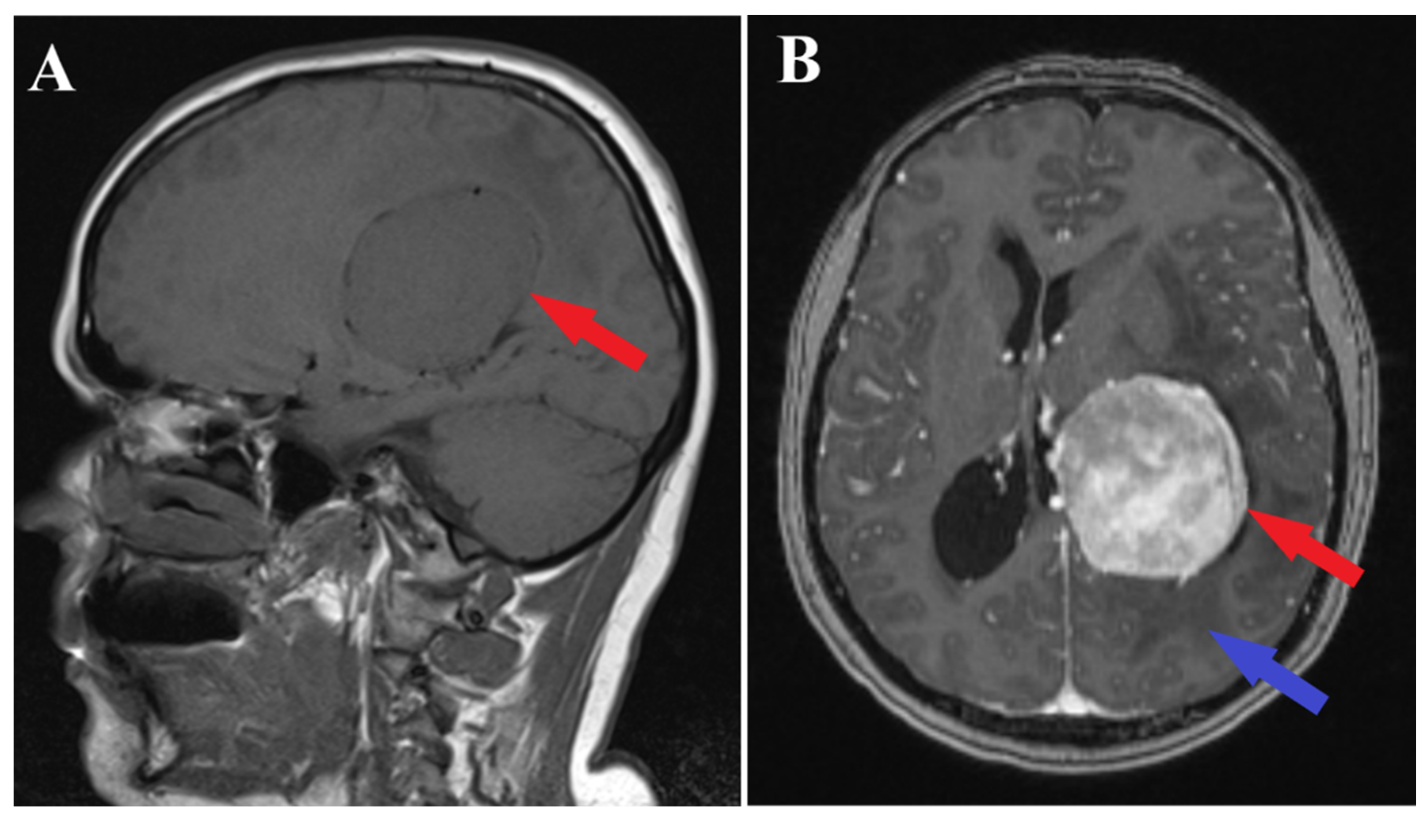Medicina 60 00560 g001