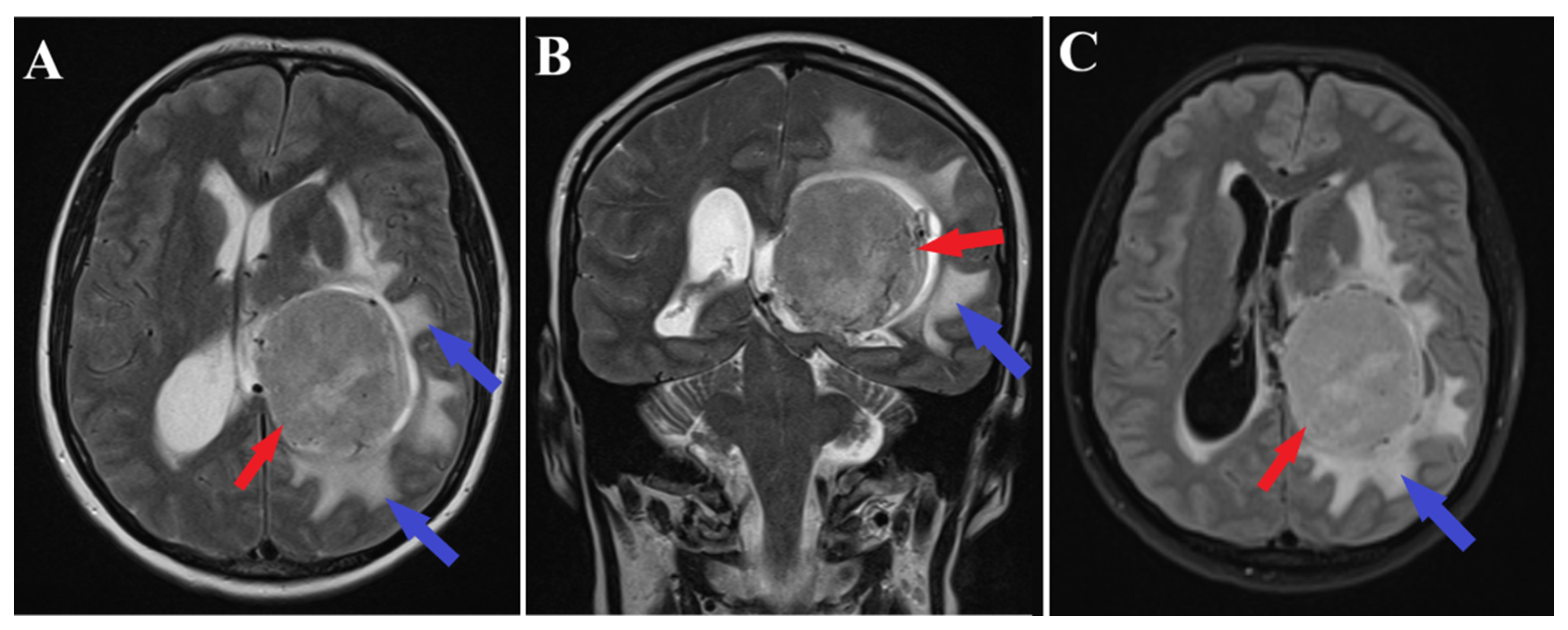 Medicina 60 00560 g002