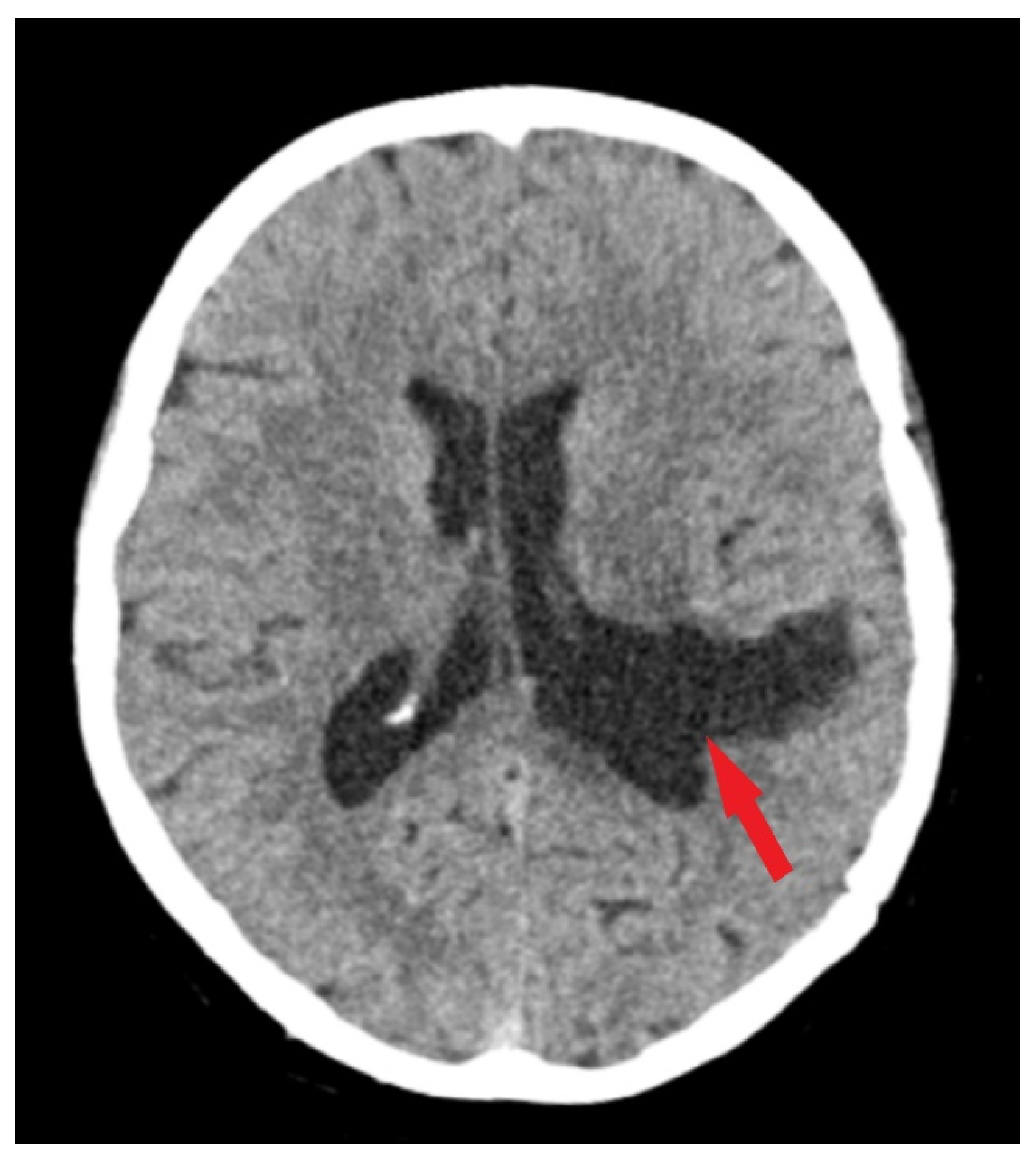 Medicina 60 00560 g003