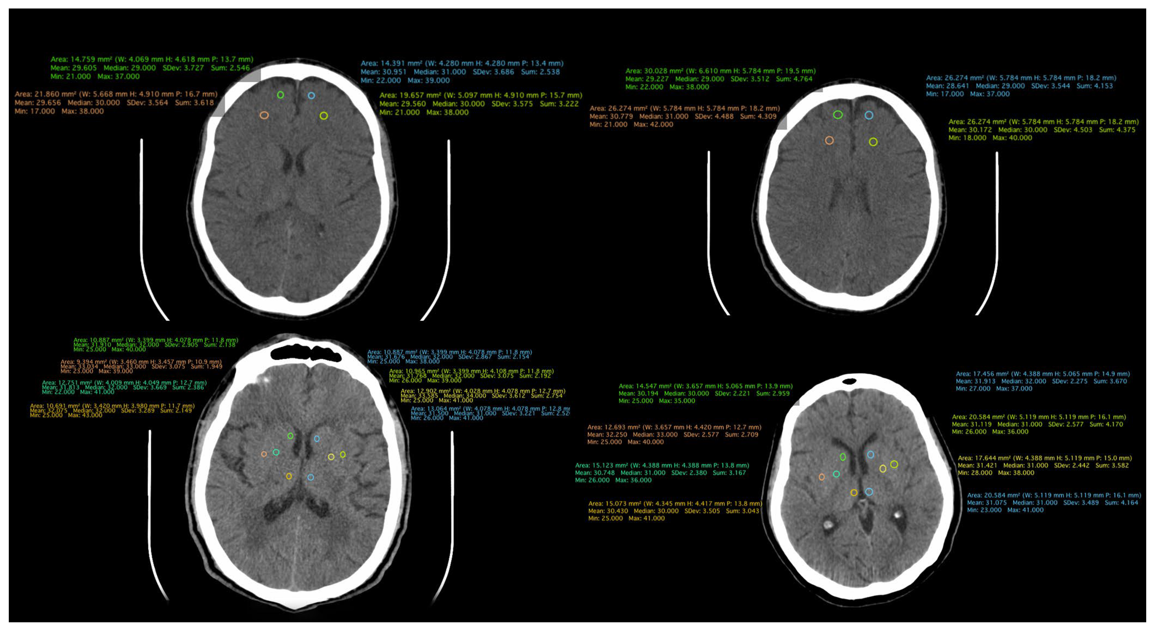 Medicina 60 00564 g002