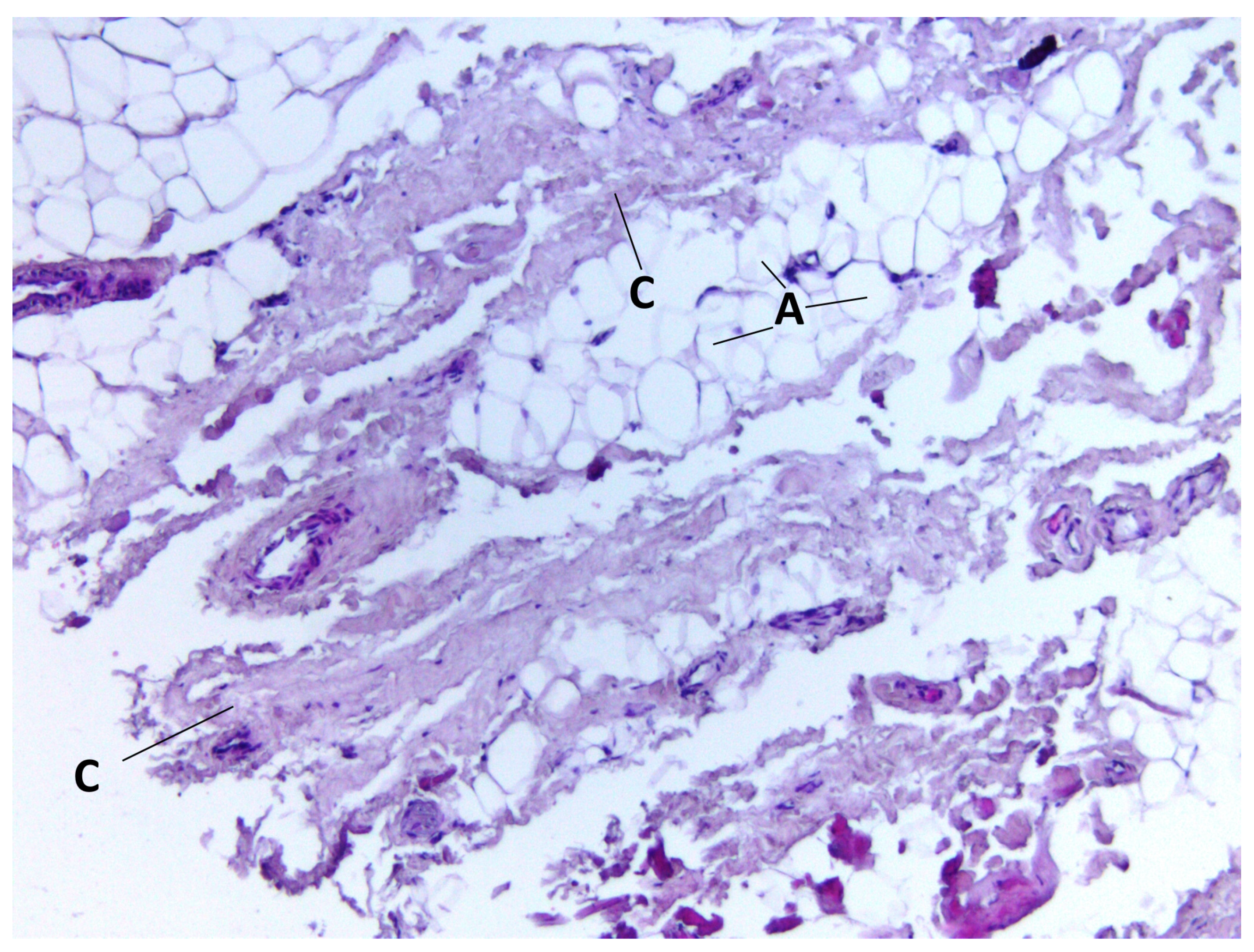 Medicina 60 00567 g003