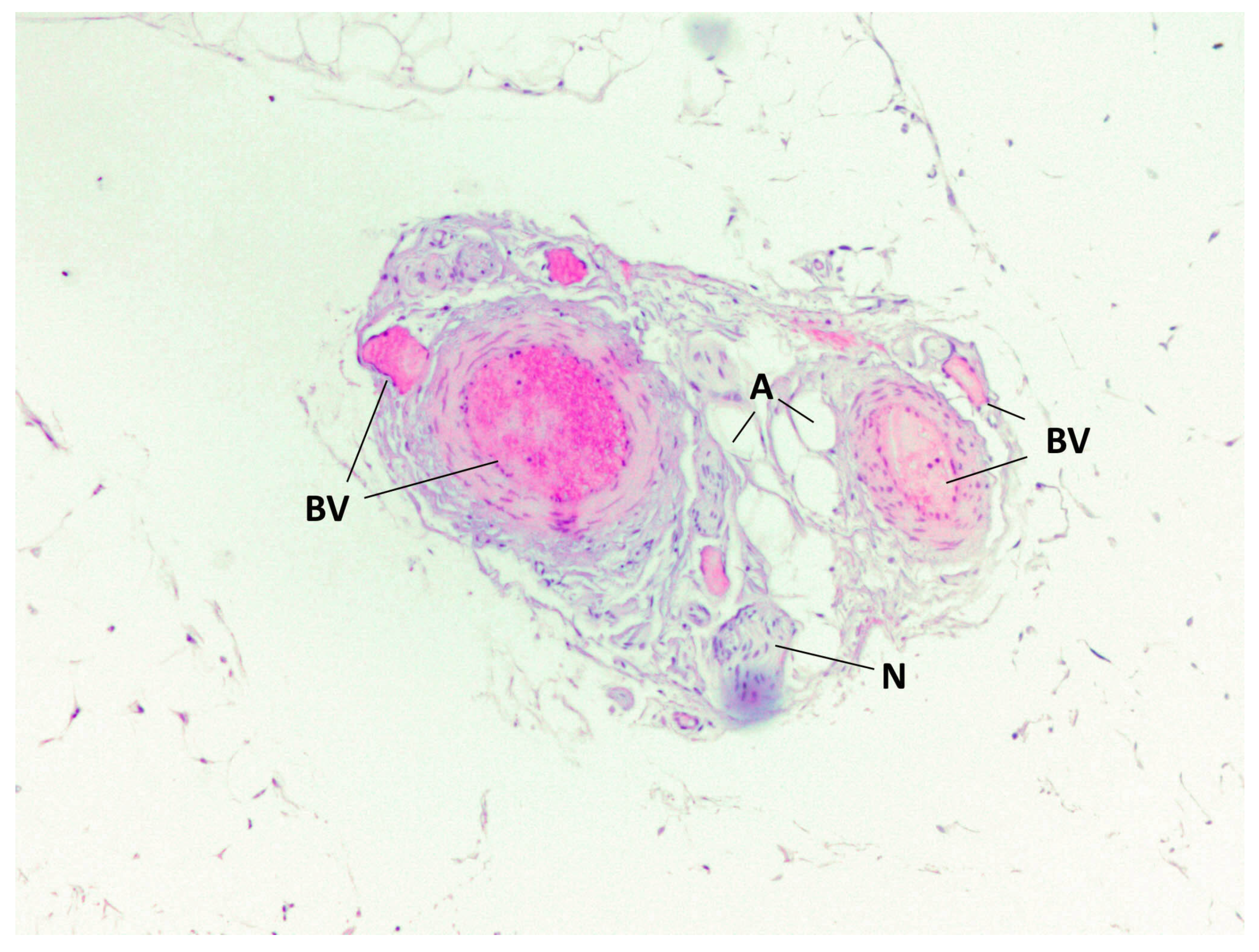 Medicina 60 00567 g004