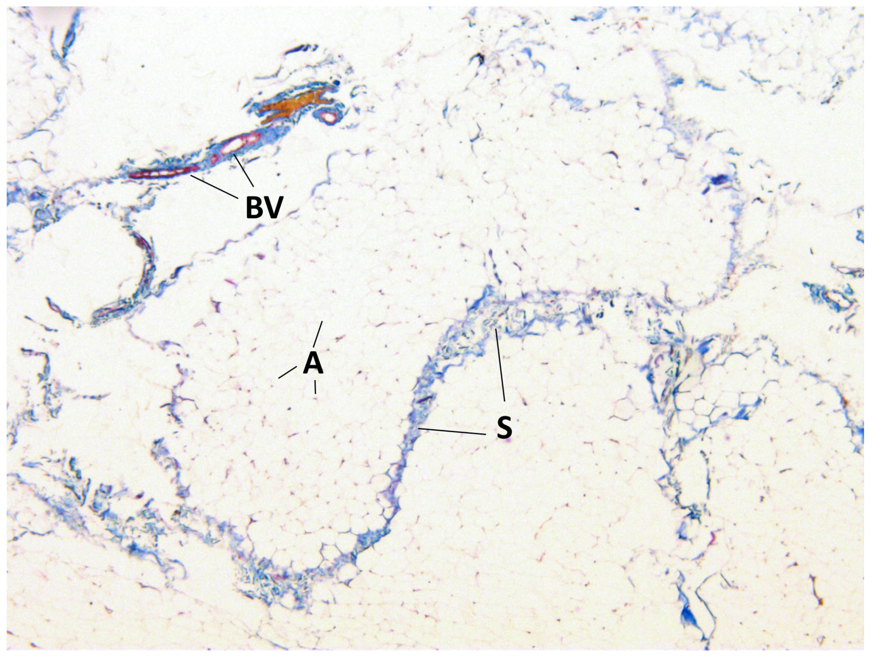 Medicina 60 00567 g005