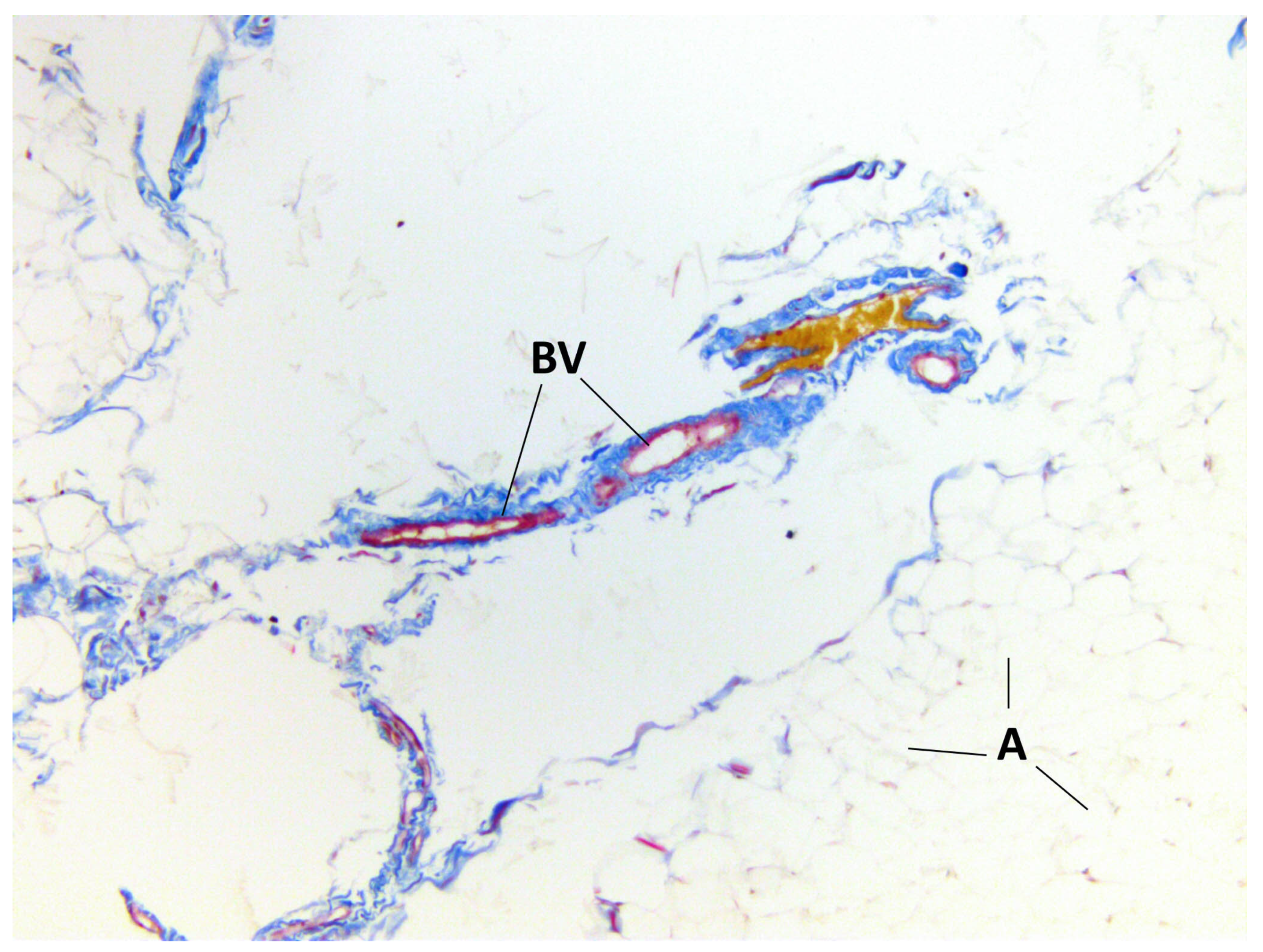 Medicina 60 00567 g006