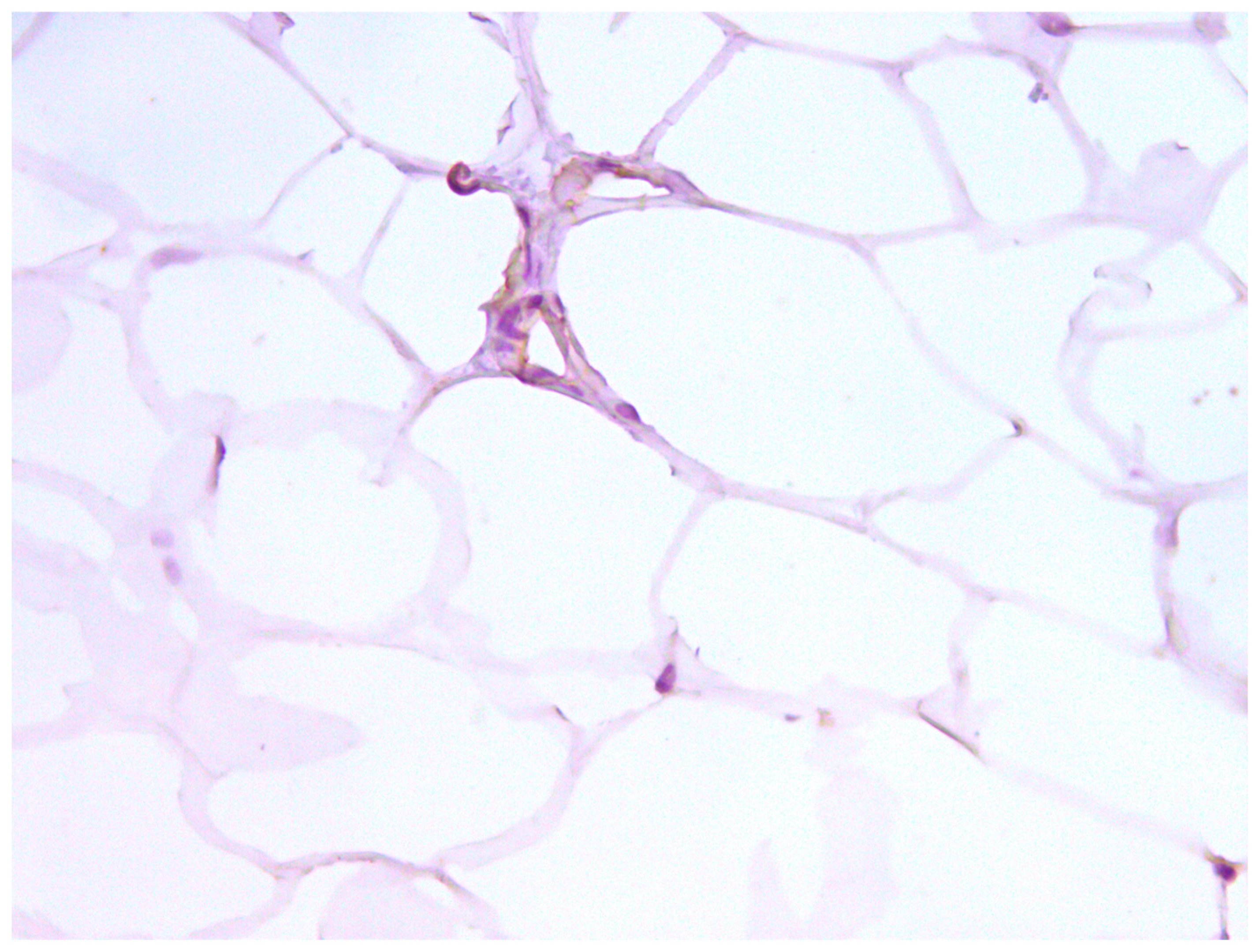 Medicina 60 00567 g012