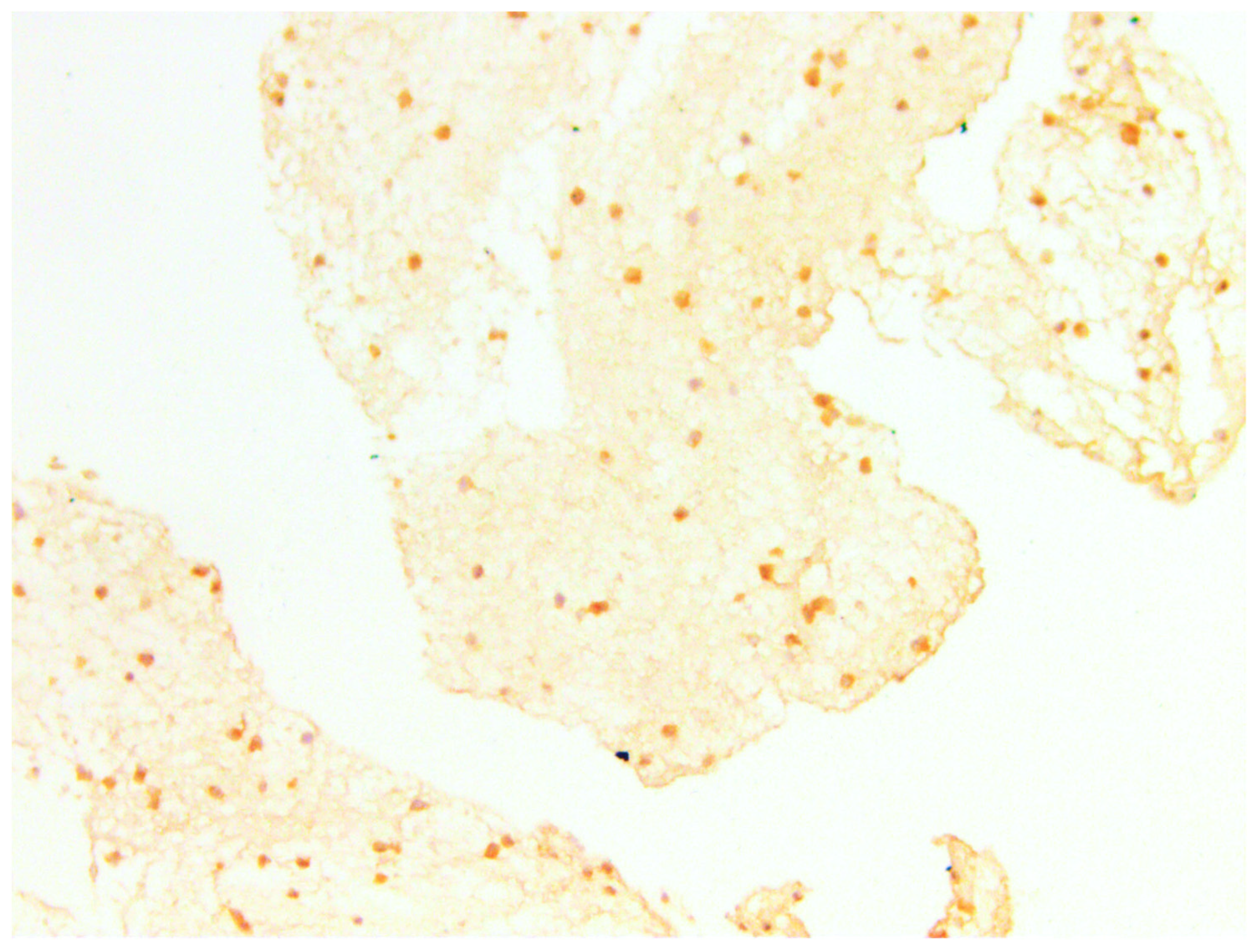 Medicina 60 00567 g016