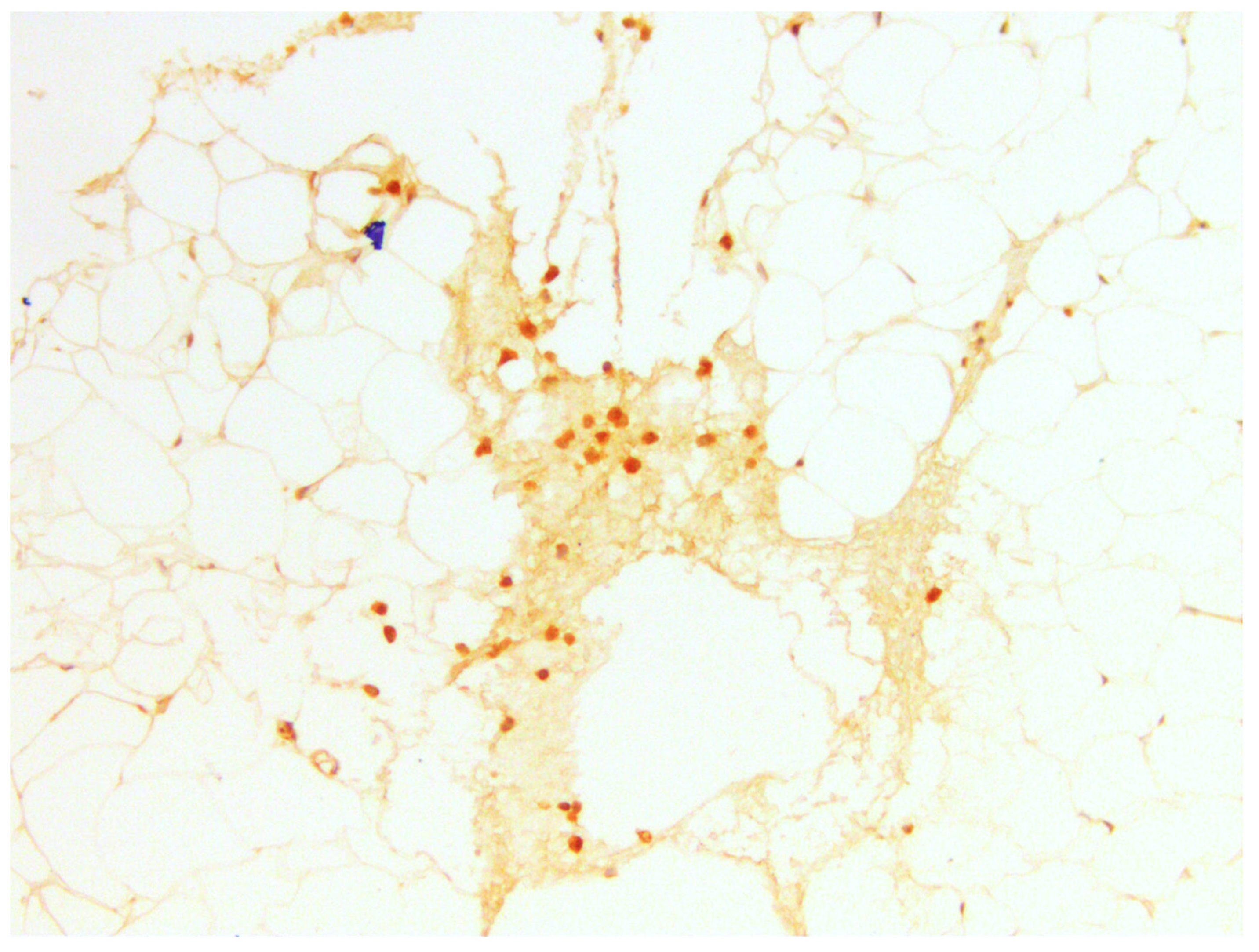 Medicina 60 00567 g017