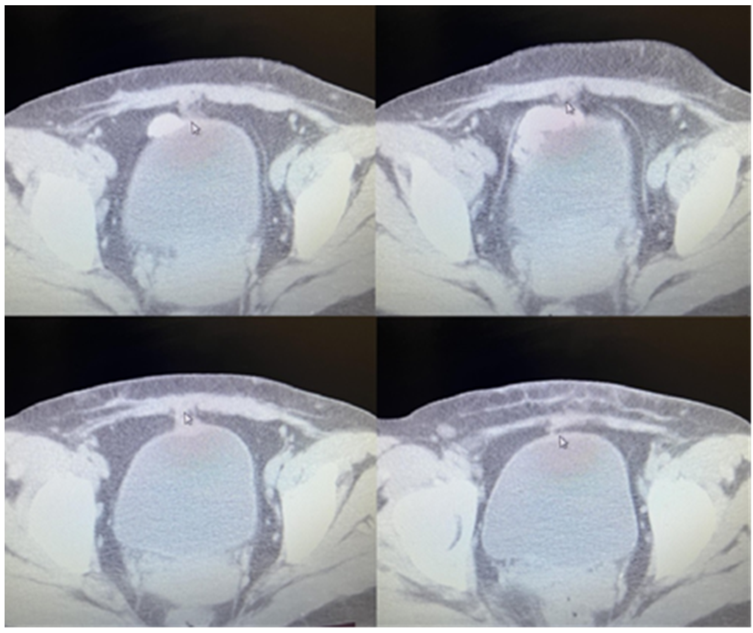 Medicina 60 00576 g002 Medicina 60 00576 g002