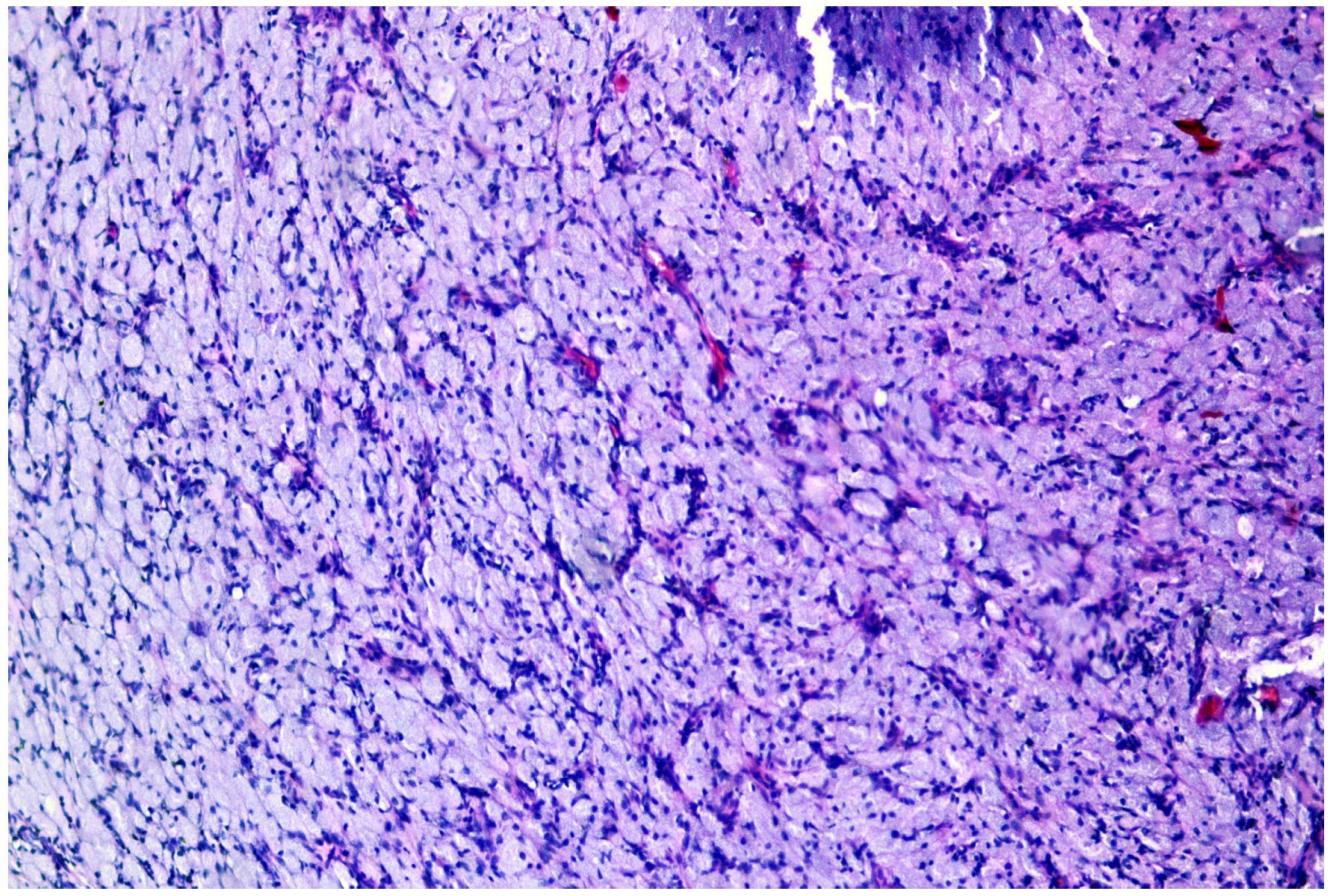 Medicina 60 00576 g003 Medicina 60 00576 g003