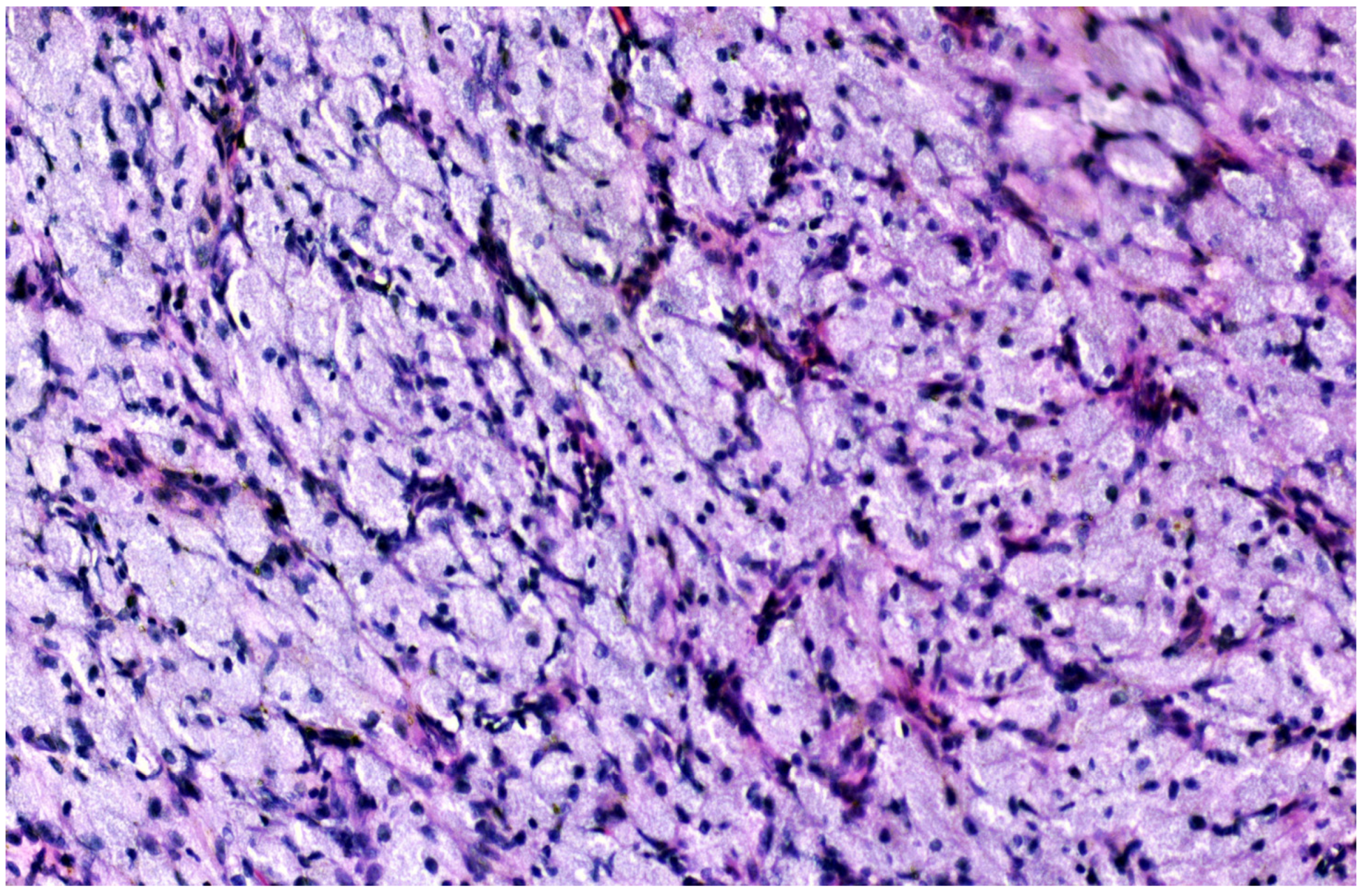 Medicina 60 00576 g004 Medicina 60 00576 g004