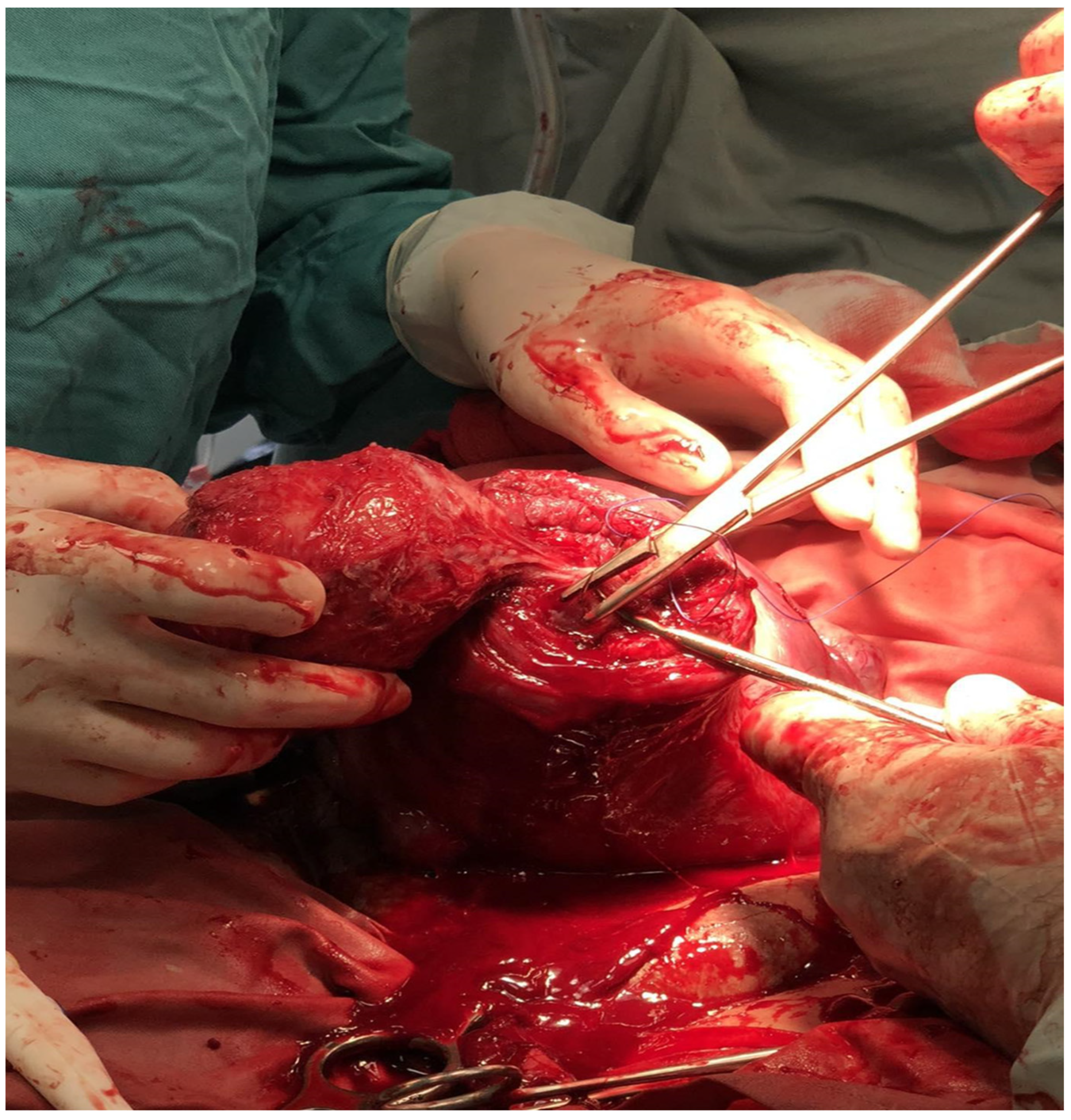 Medicina 60 00594 g003