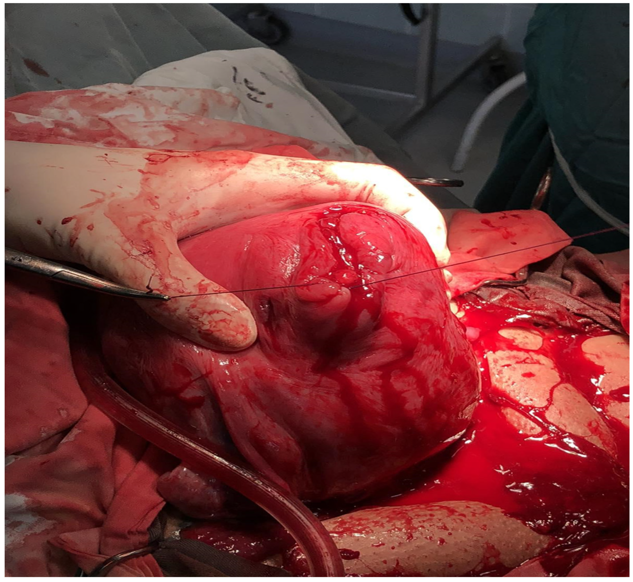 Medicina 60 00594 g004