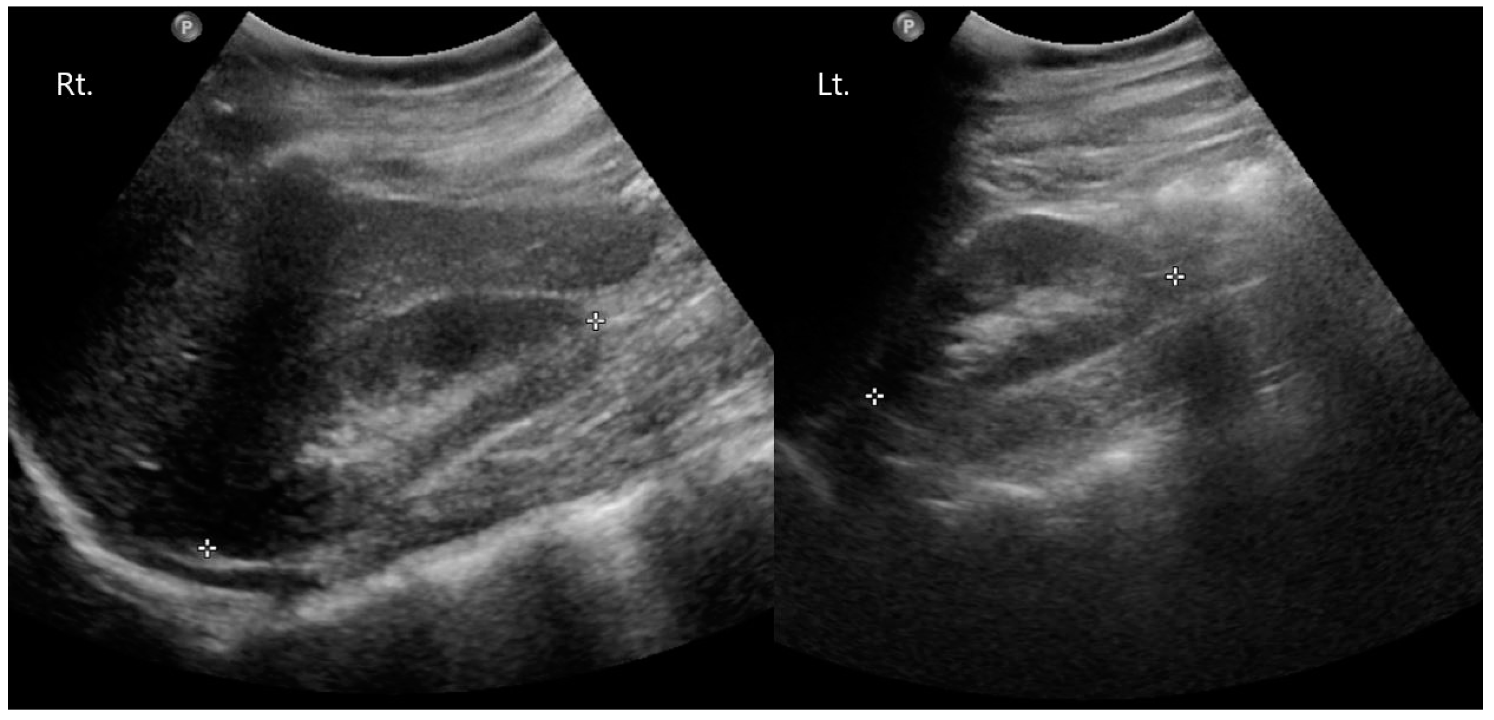 Medicina 60 00595 g004