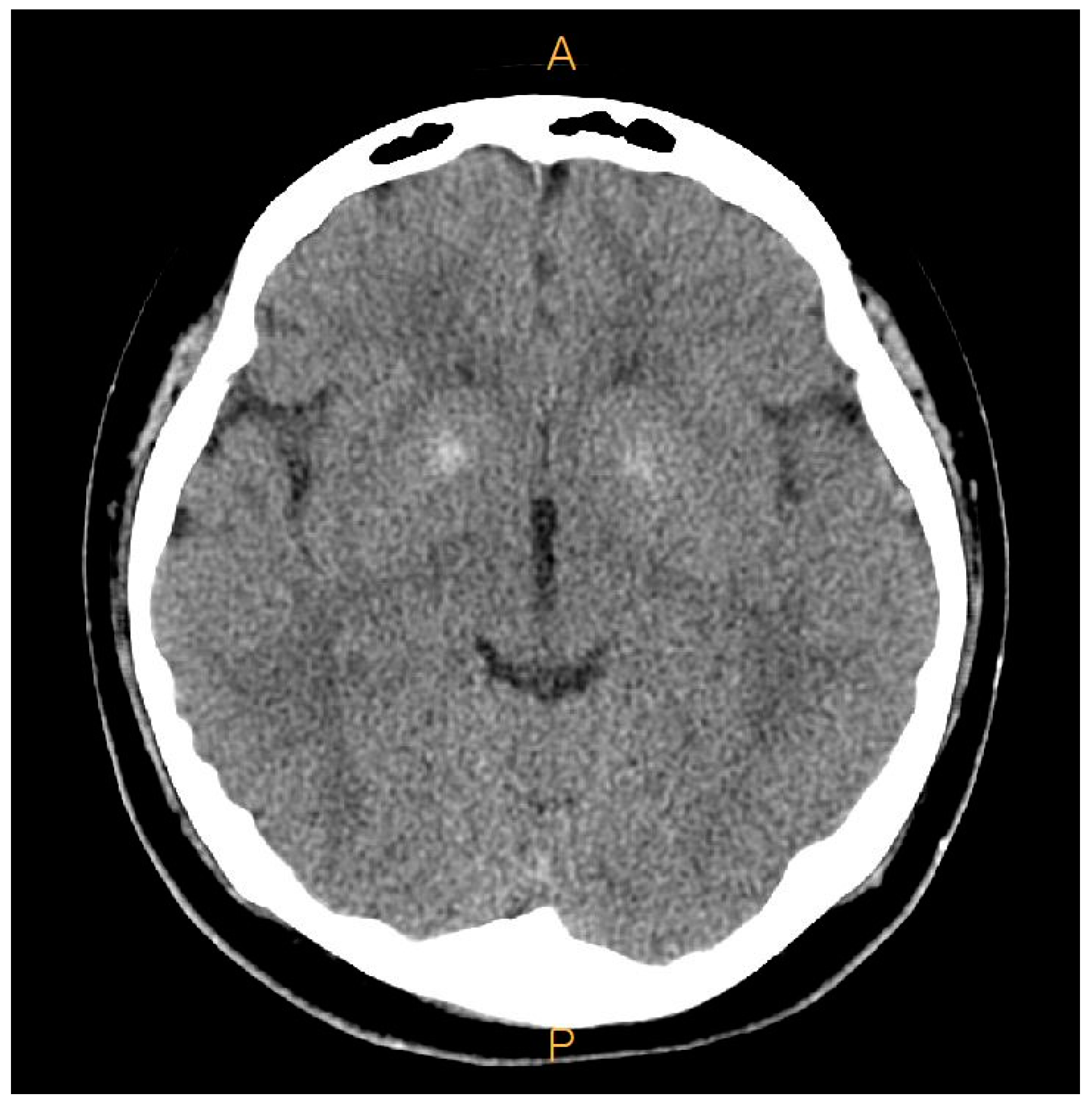 Medicina 60 00595 g005