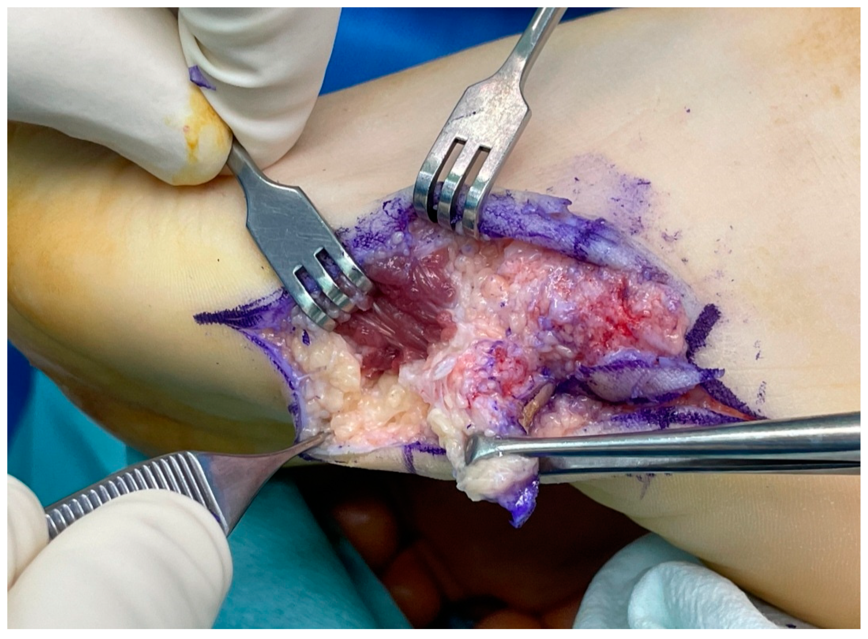 Medicina 60 00595 g006