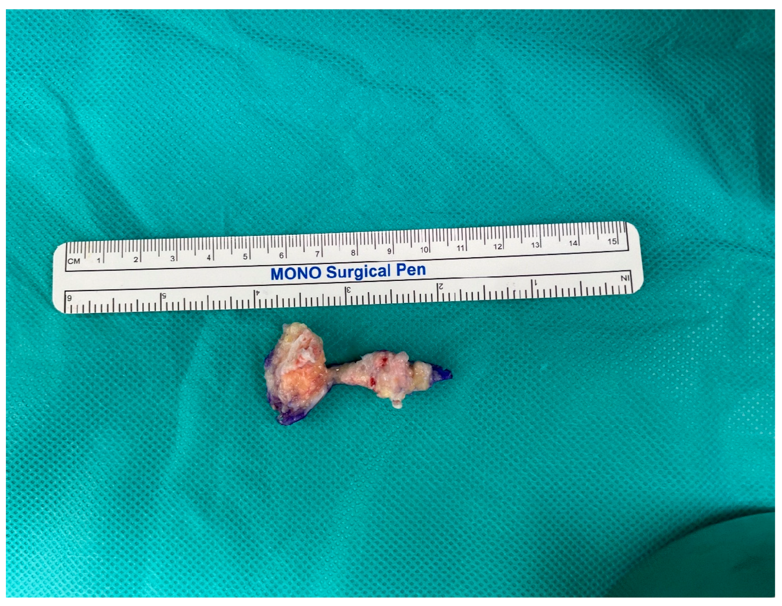 Medicina 60 00595 g007