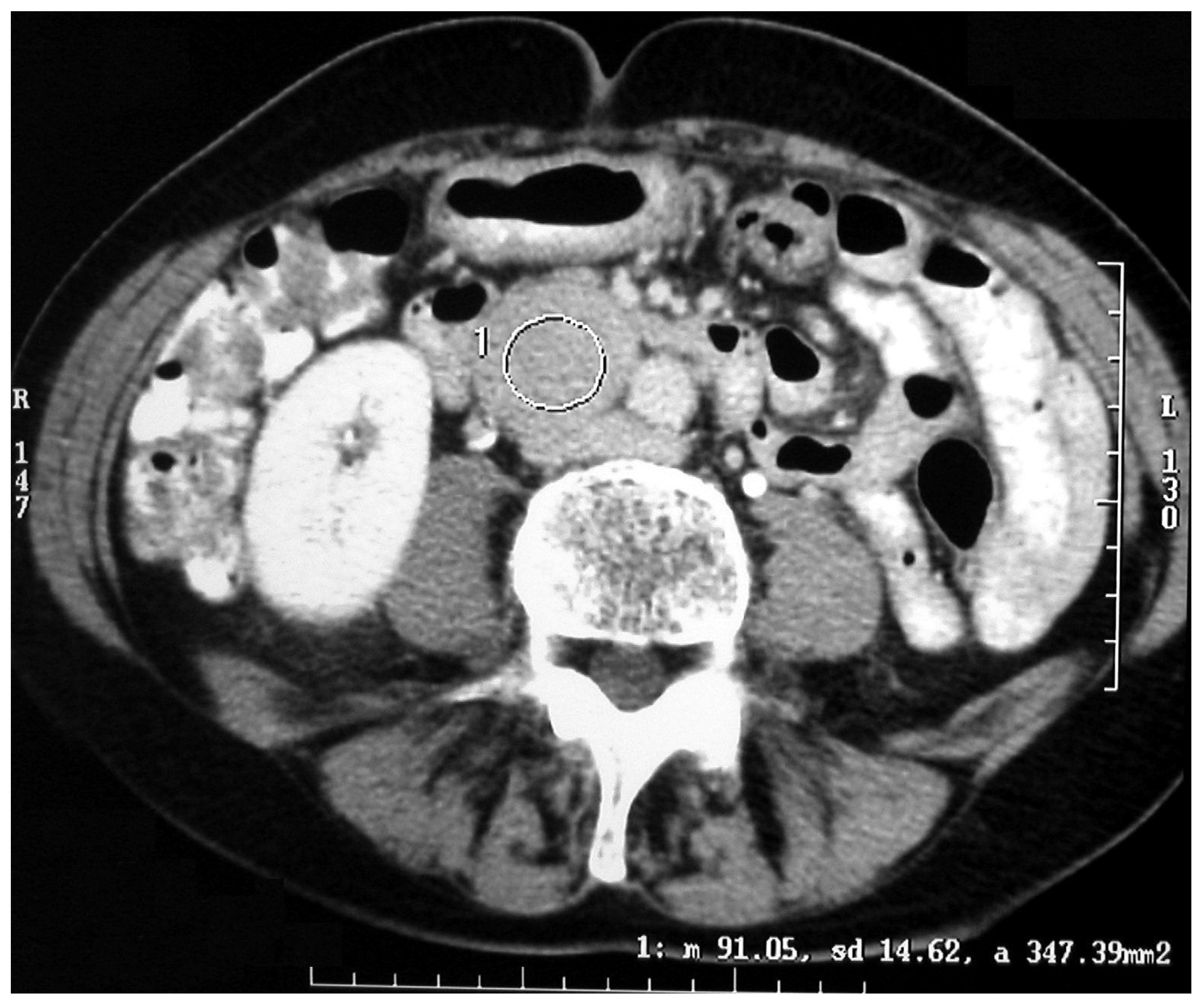 Medicina 60 00604 g003