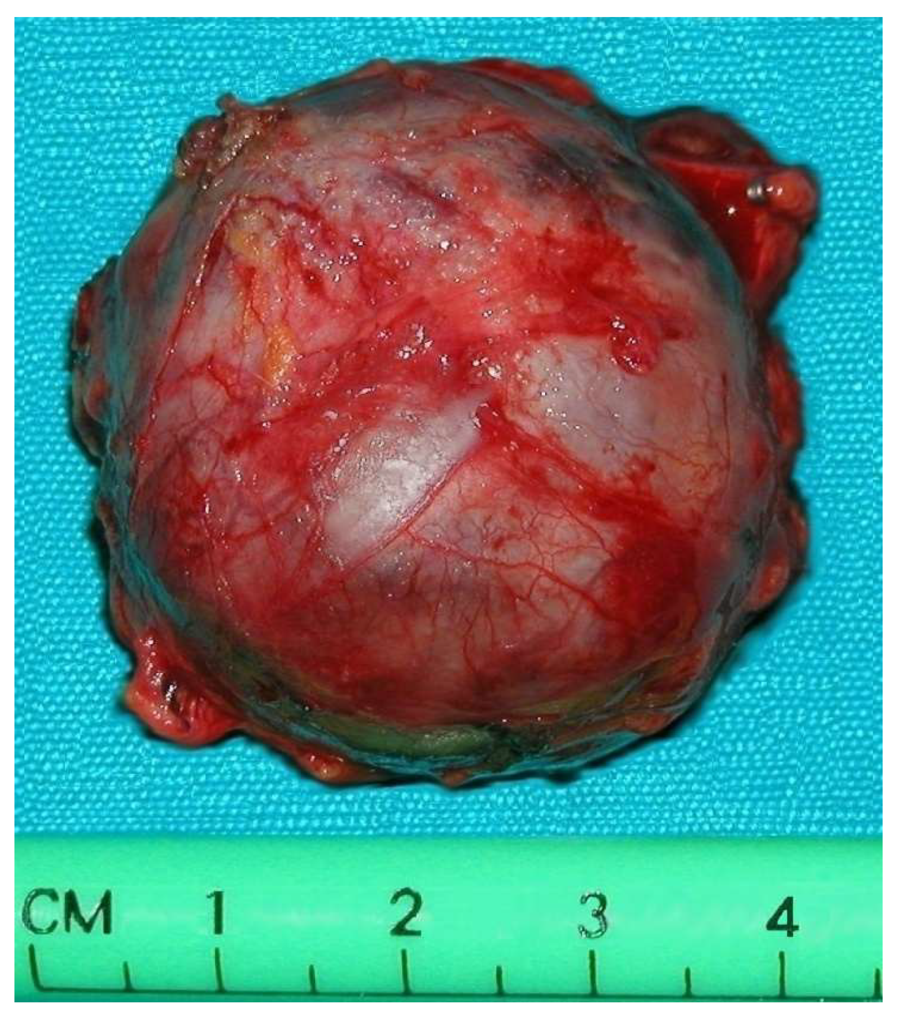 Medicina 60 00604 g004