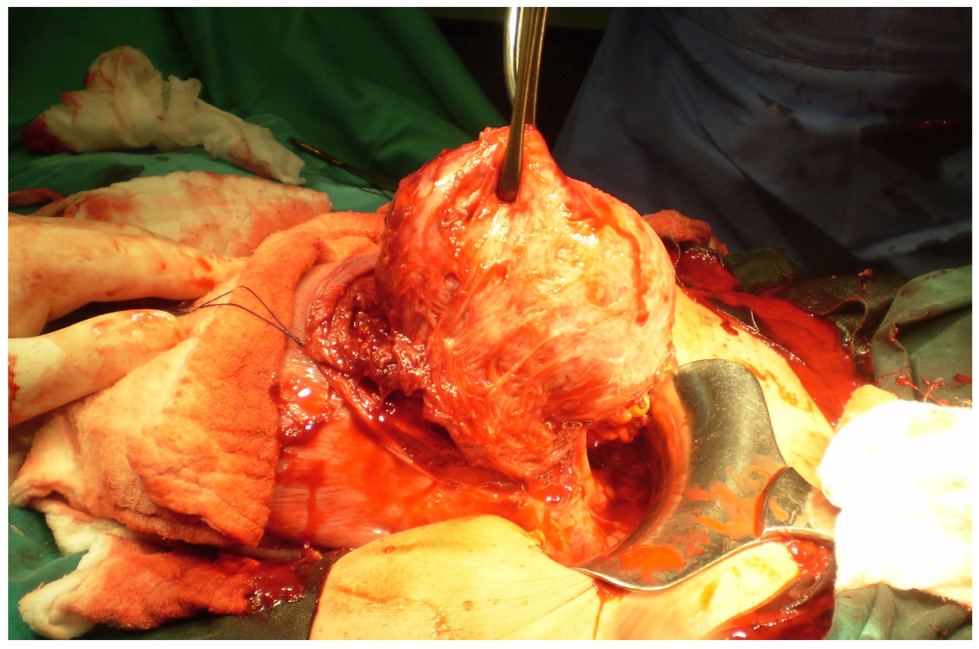 Medicina 60 00609 g002