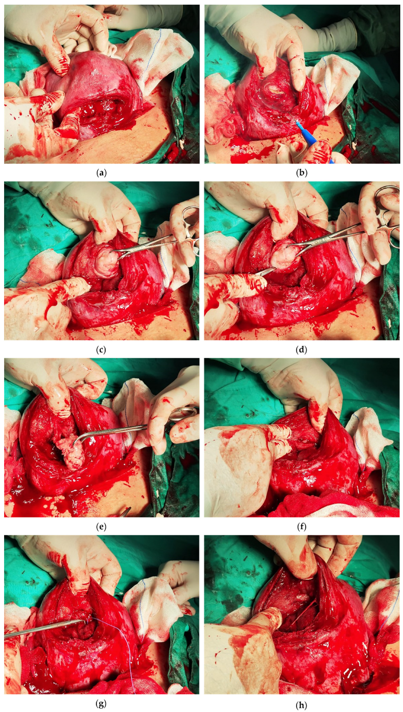 Medicina 60 00609 g003