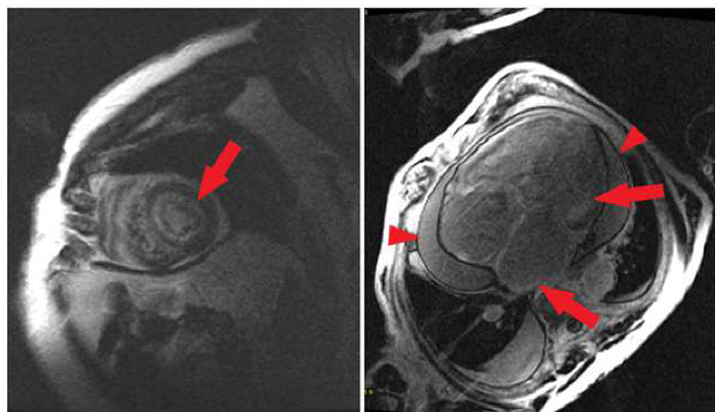 Medicina 60 00613 g004