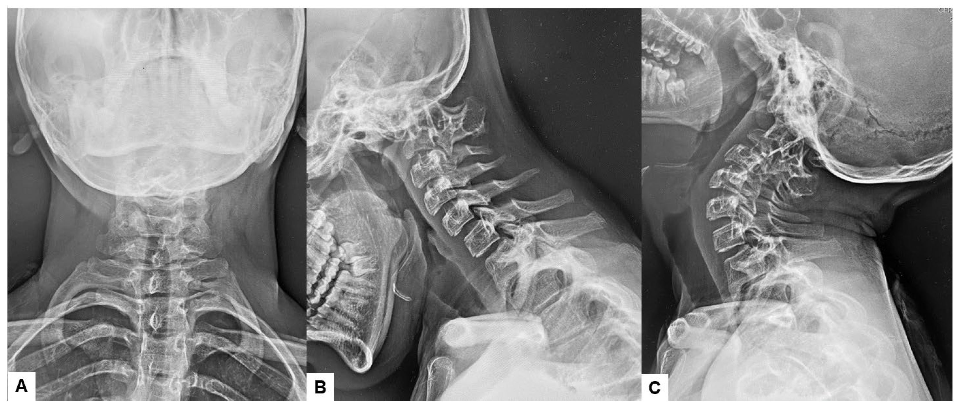 Medicina 60 00616 g002