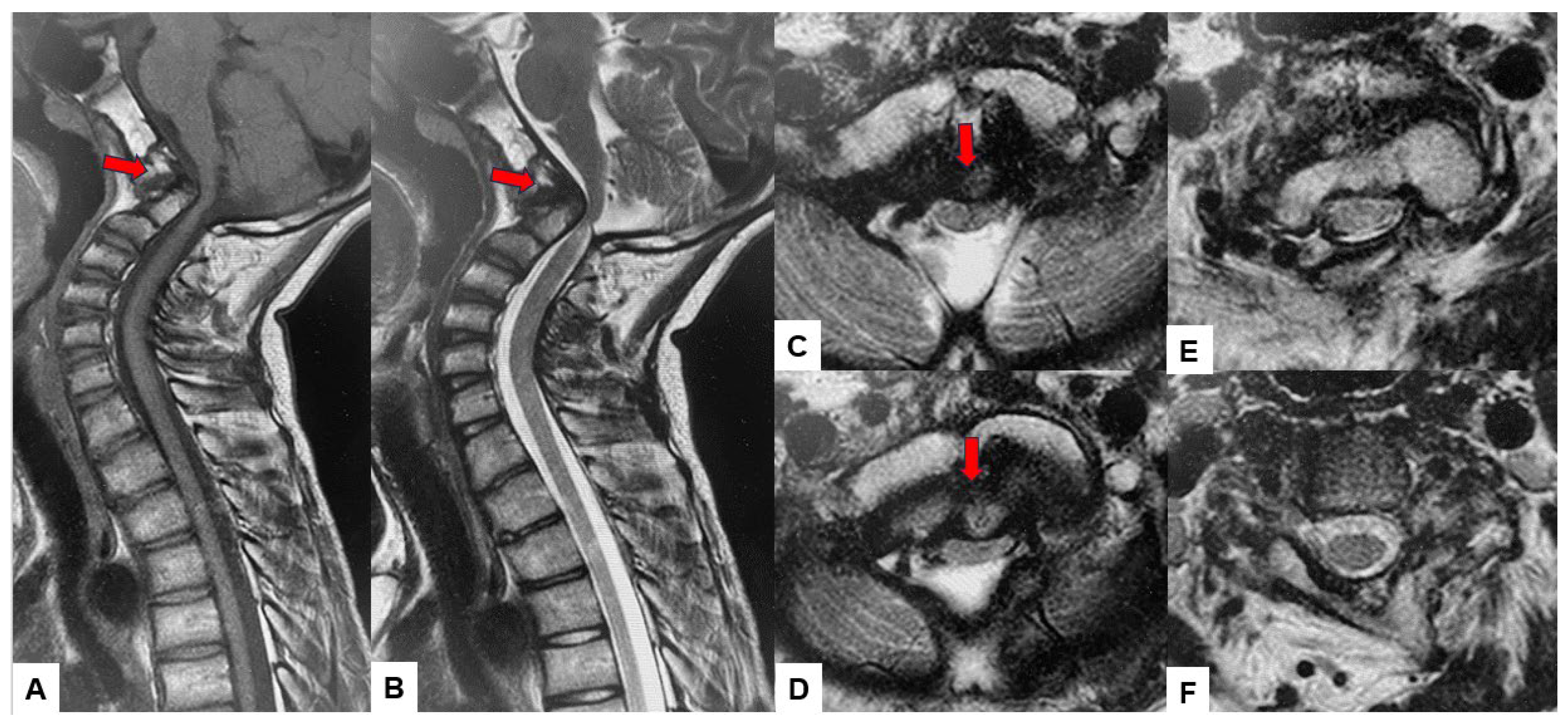 Medicina 60 00616 g003