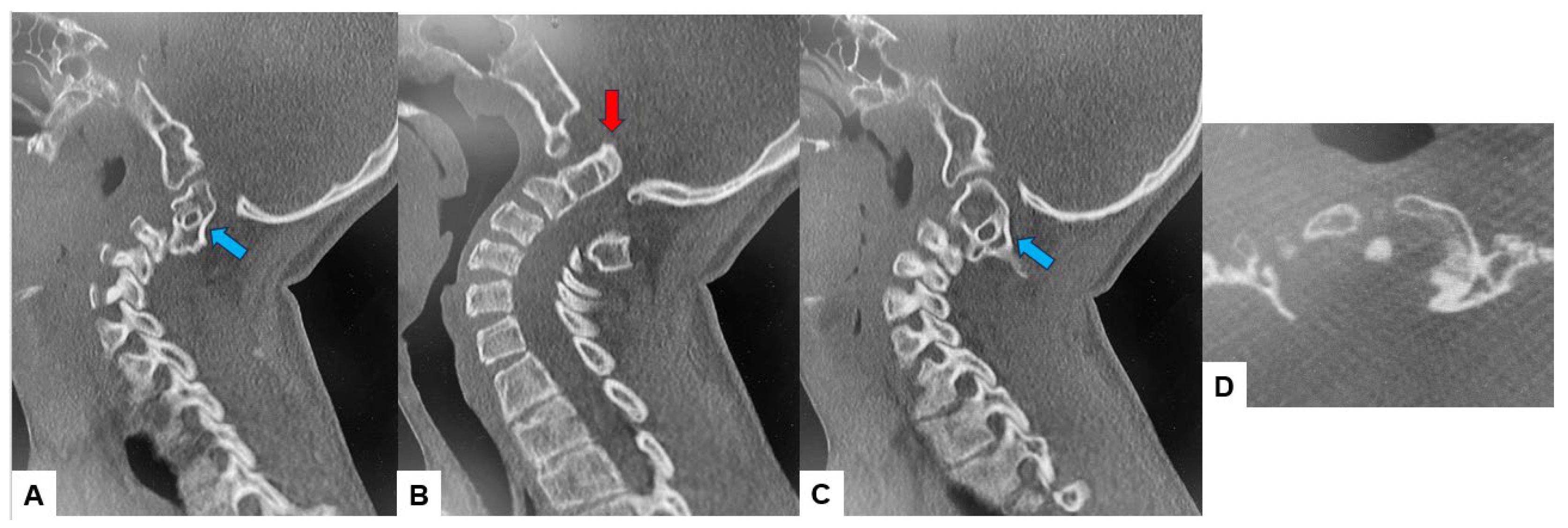 Medicina 60 00616 g004