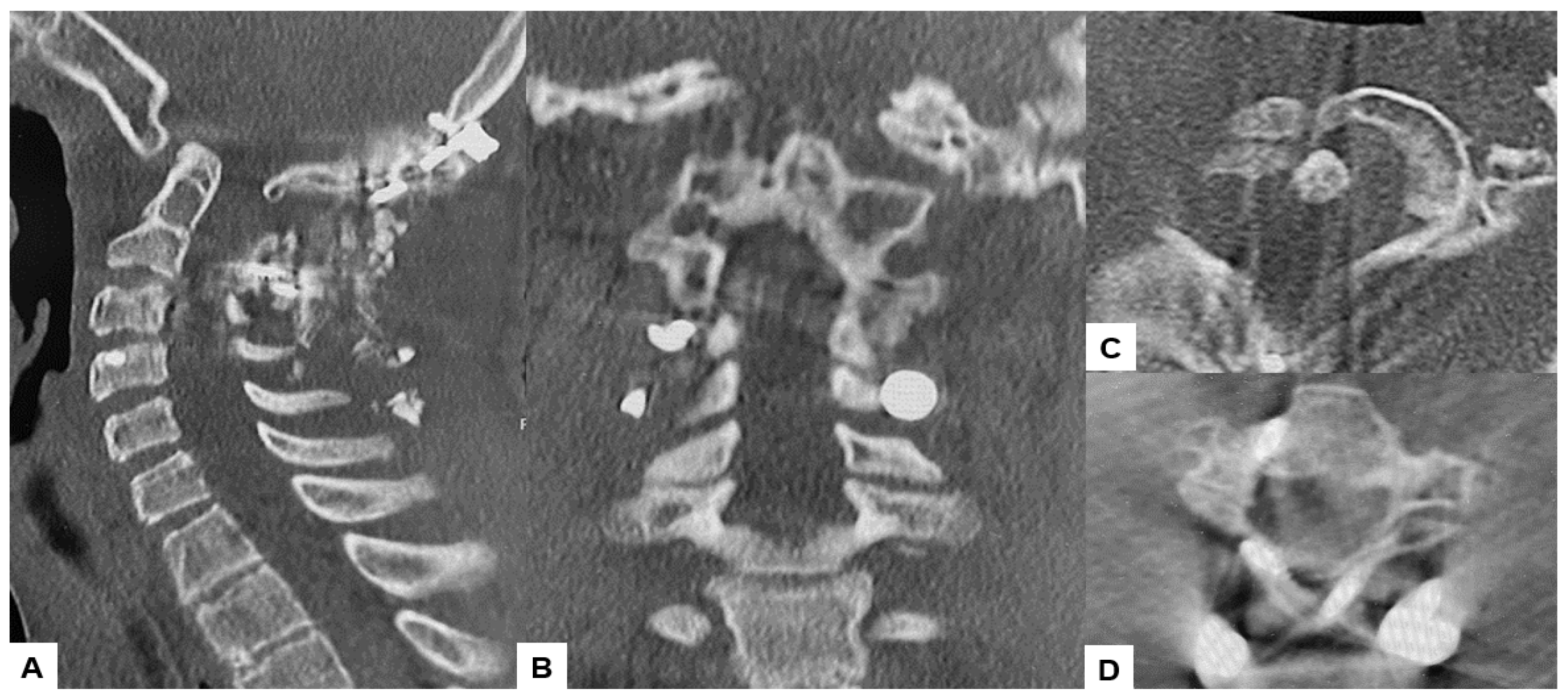 Medicina 60 00616 g014