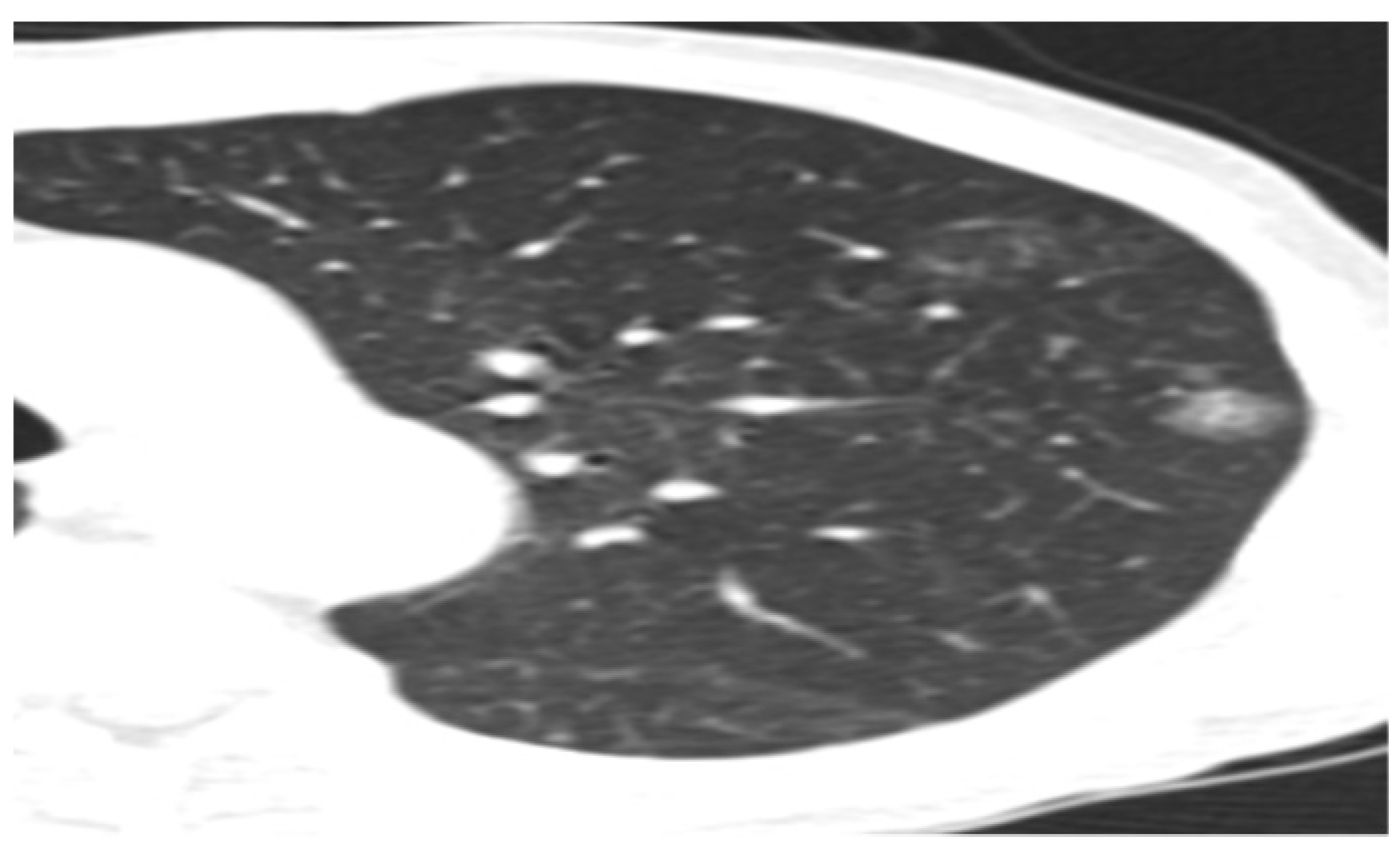 Medicina 60 00617 g002