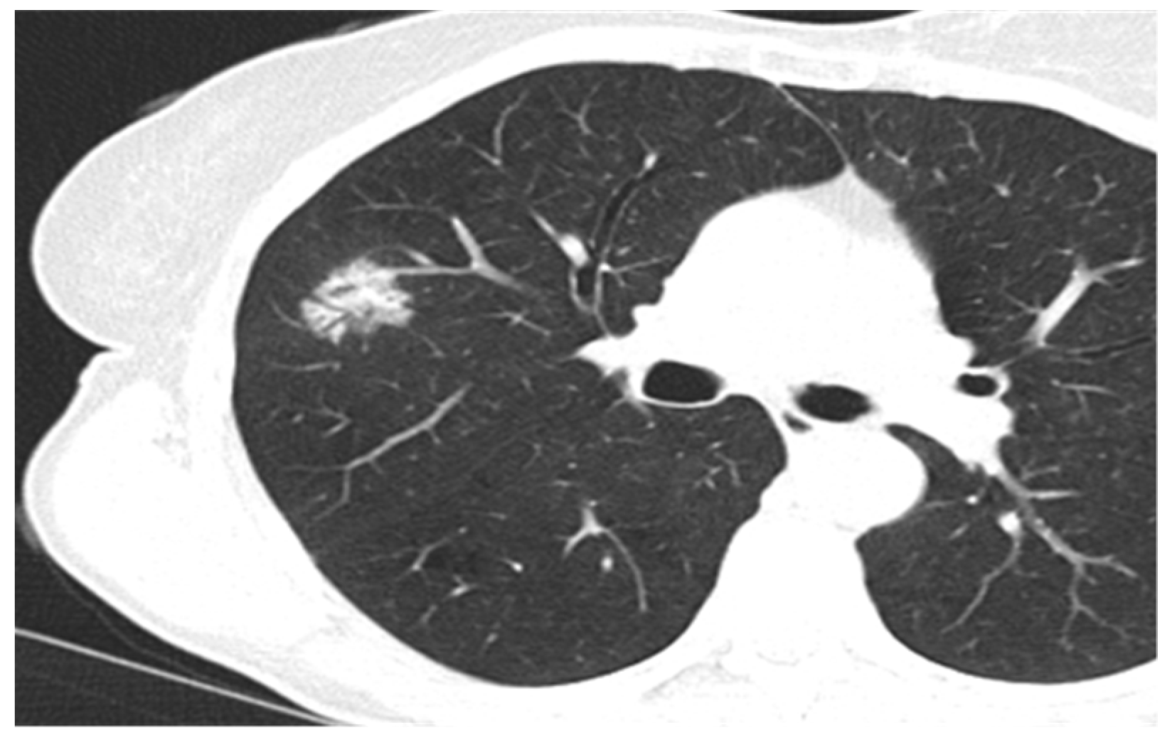 Medicina 60 00617 g003