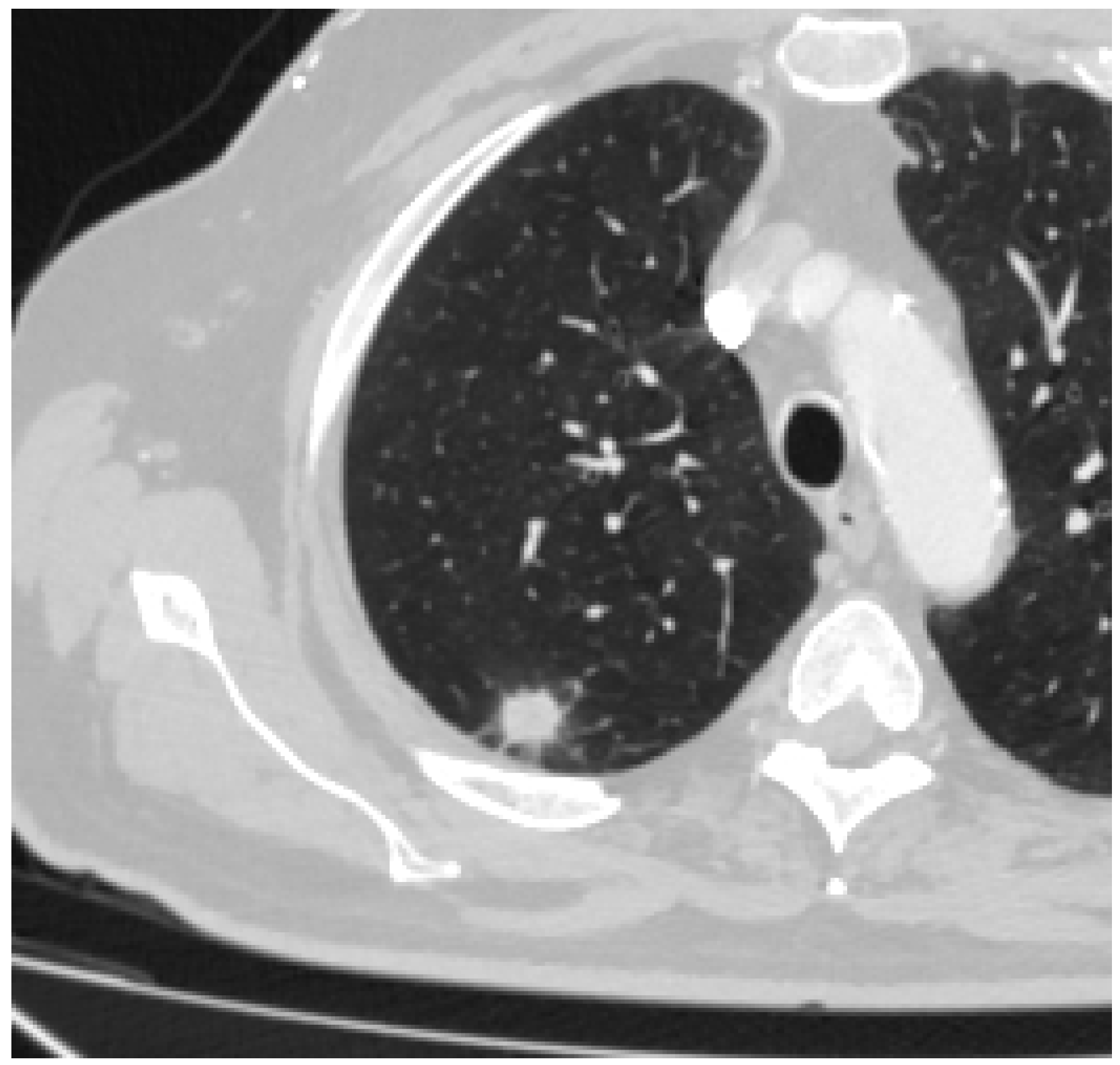Medicina 60 00617 g004