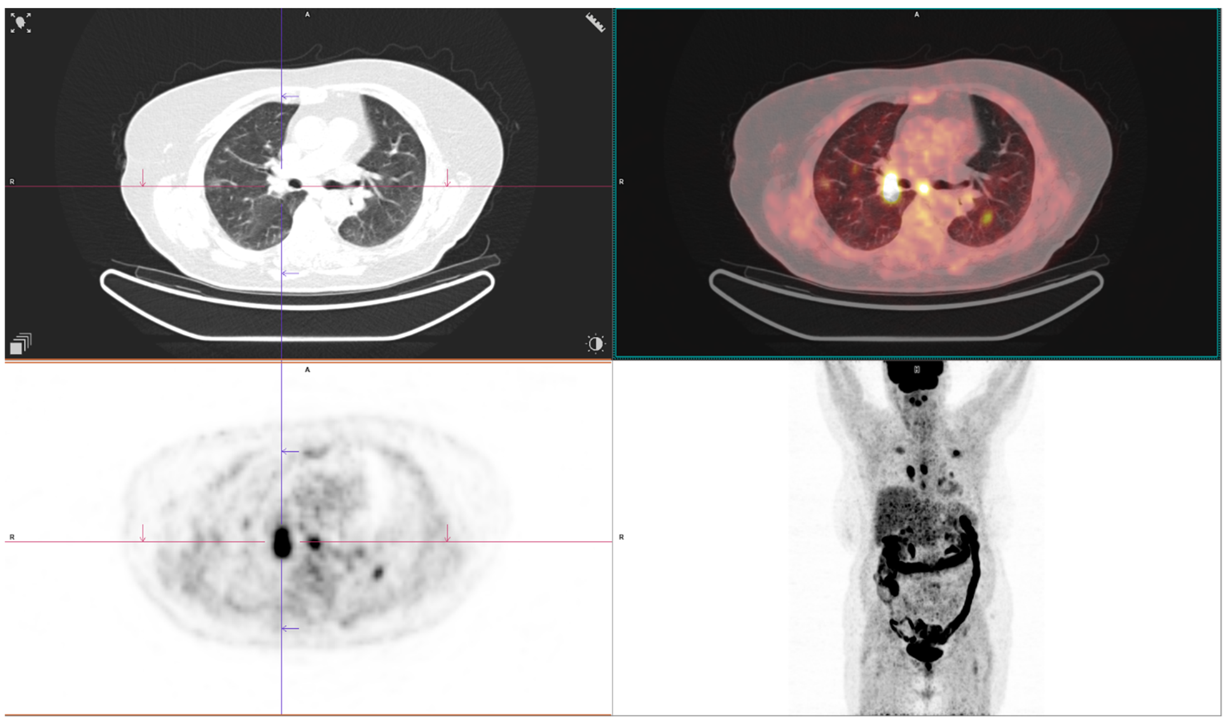 Medicina 60 00617 g005