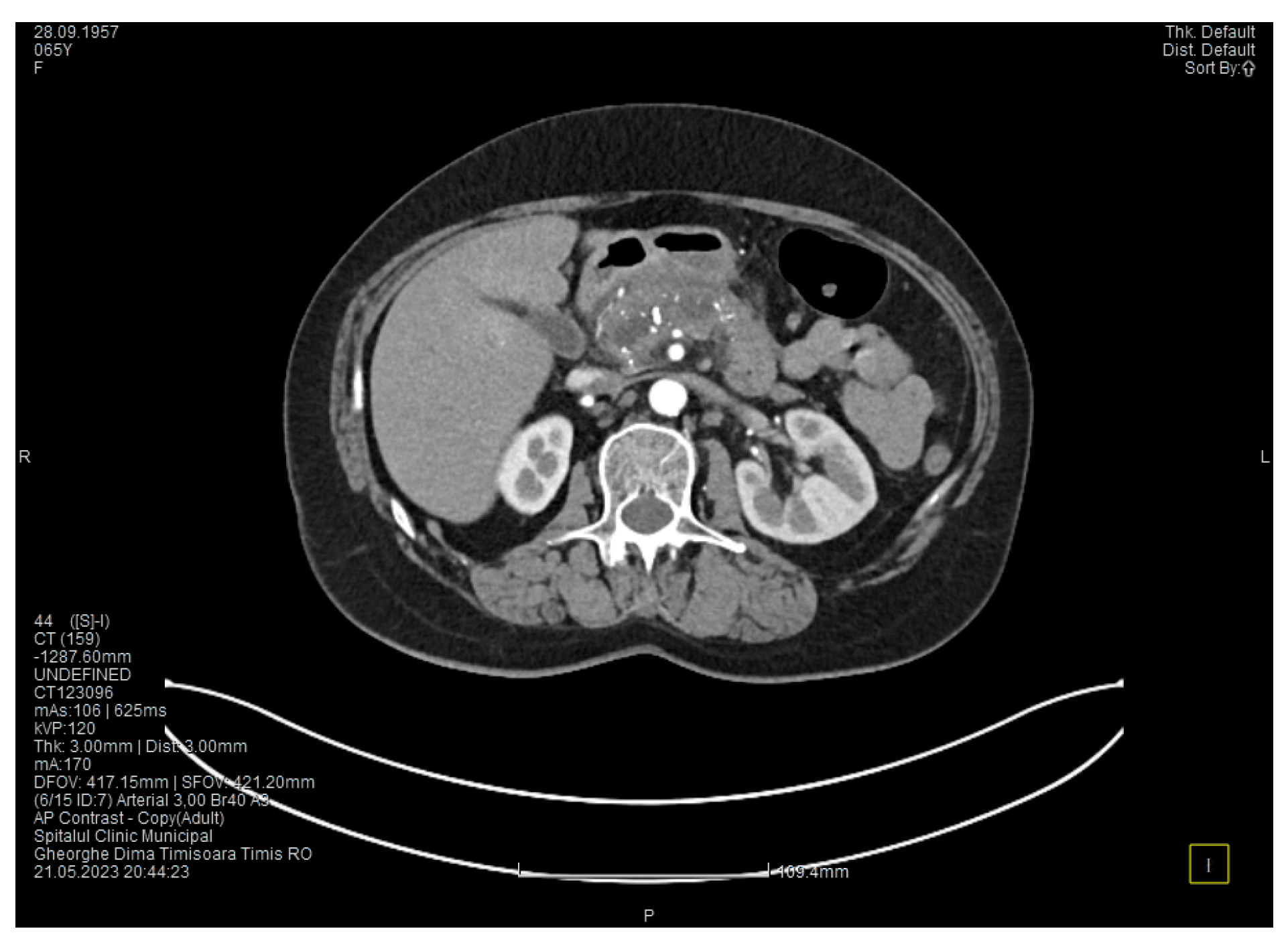 Medicina 60 00626 g003