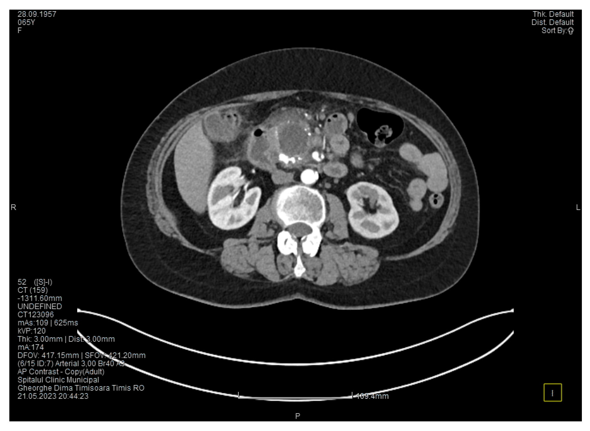 Medicina 60 00626 g004