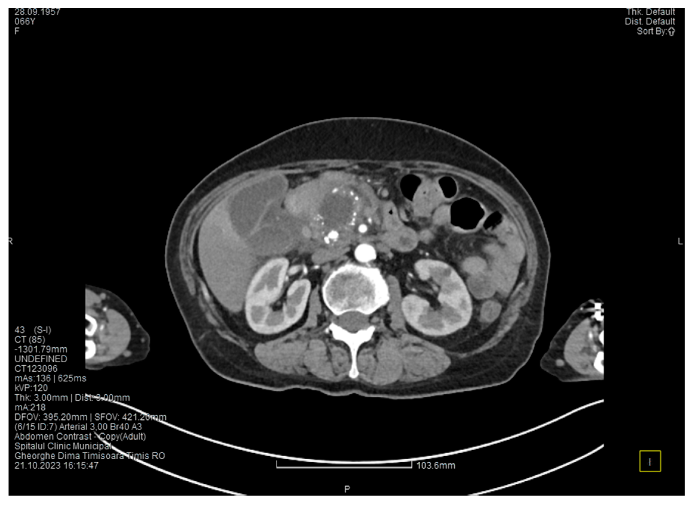 Medicina 60 00626 g006