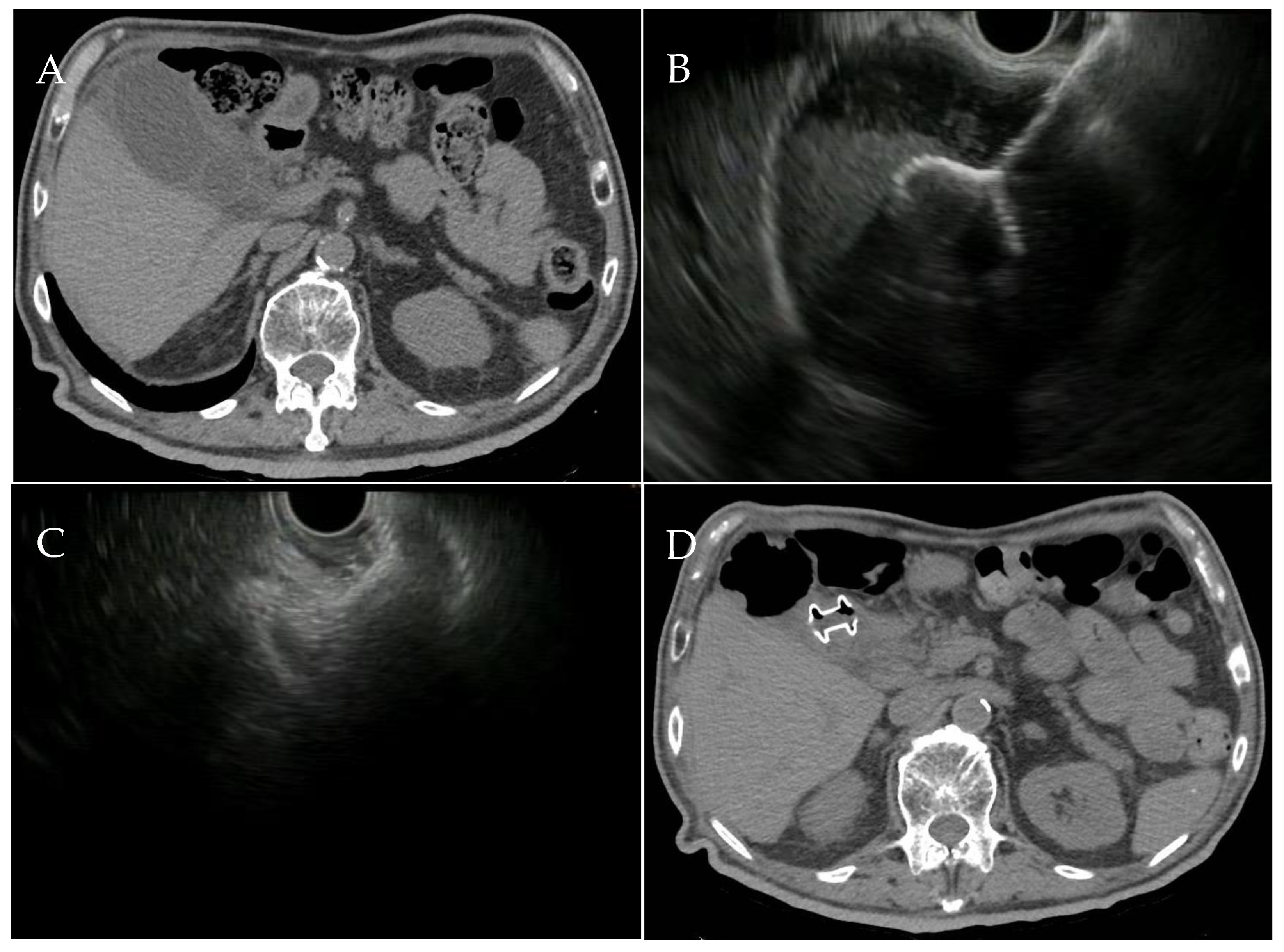 Medicina 60 00633 g002