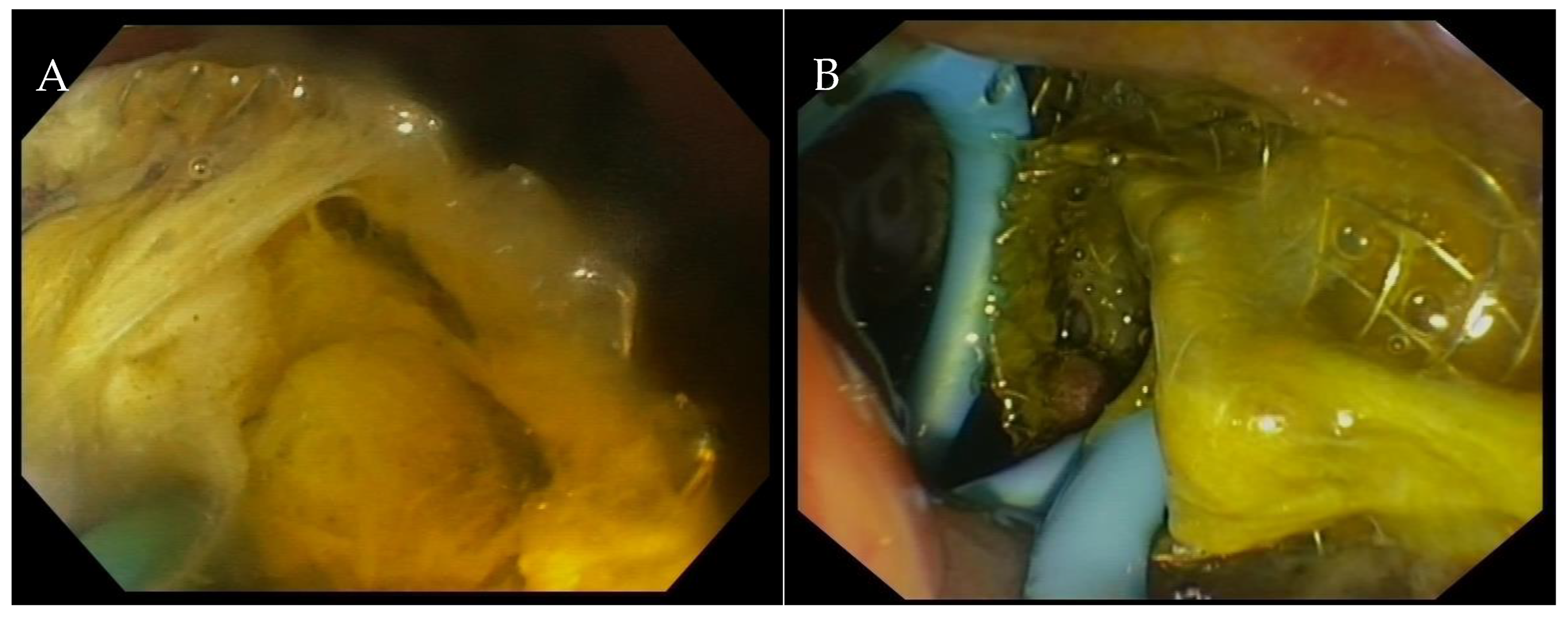 Medicina 60 00633 g004