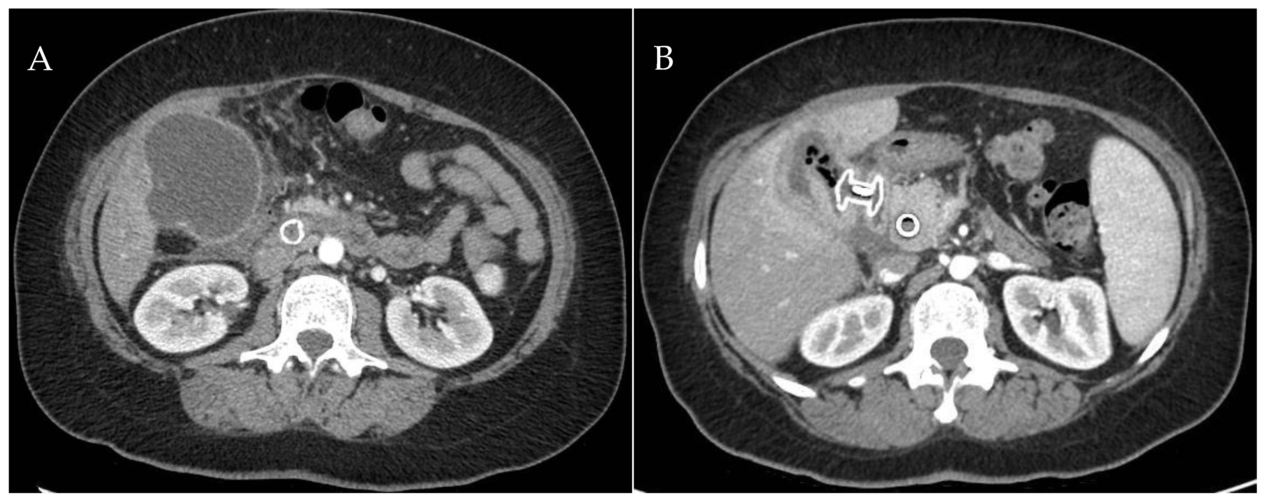 Medicina 60 00633 g005