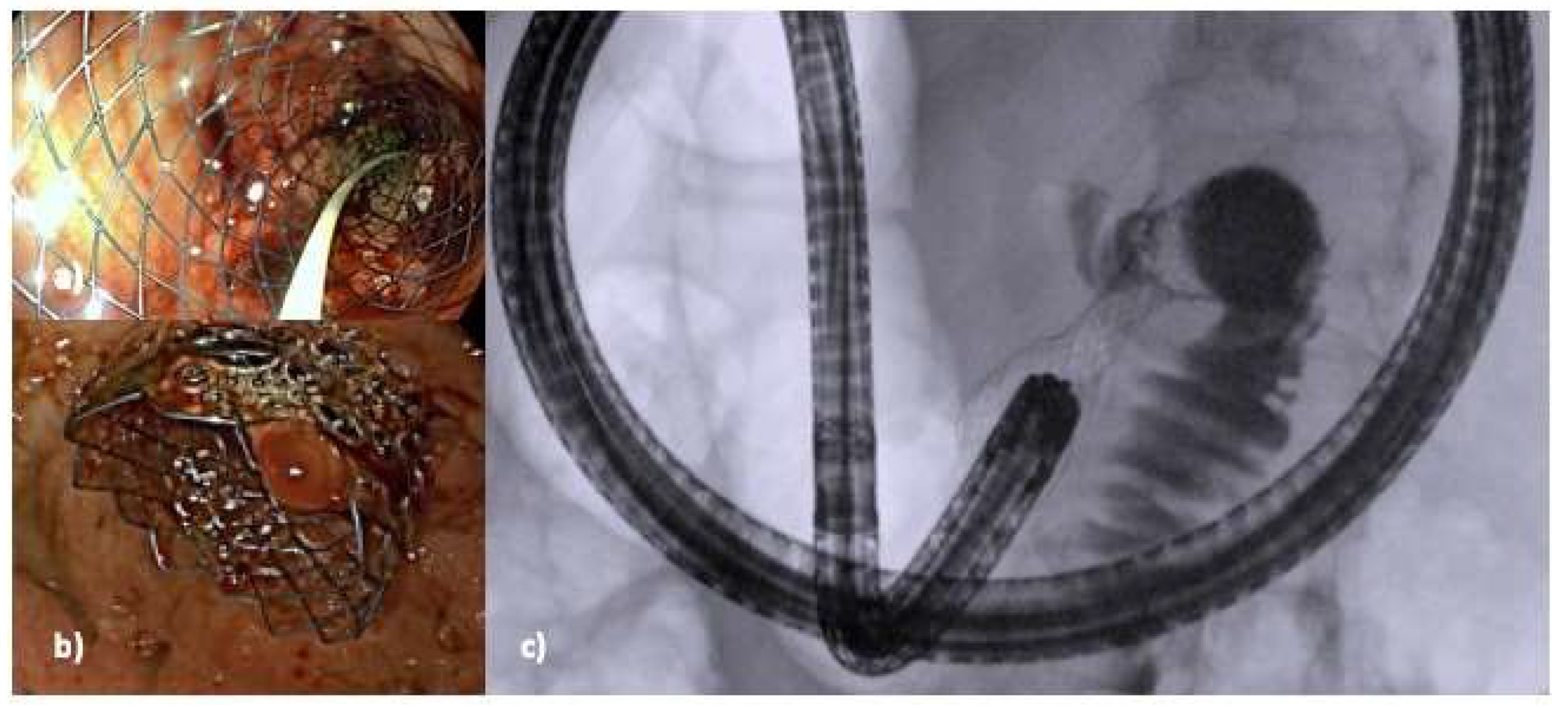 Medicina 60 00638 g002