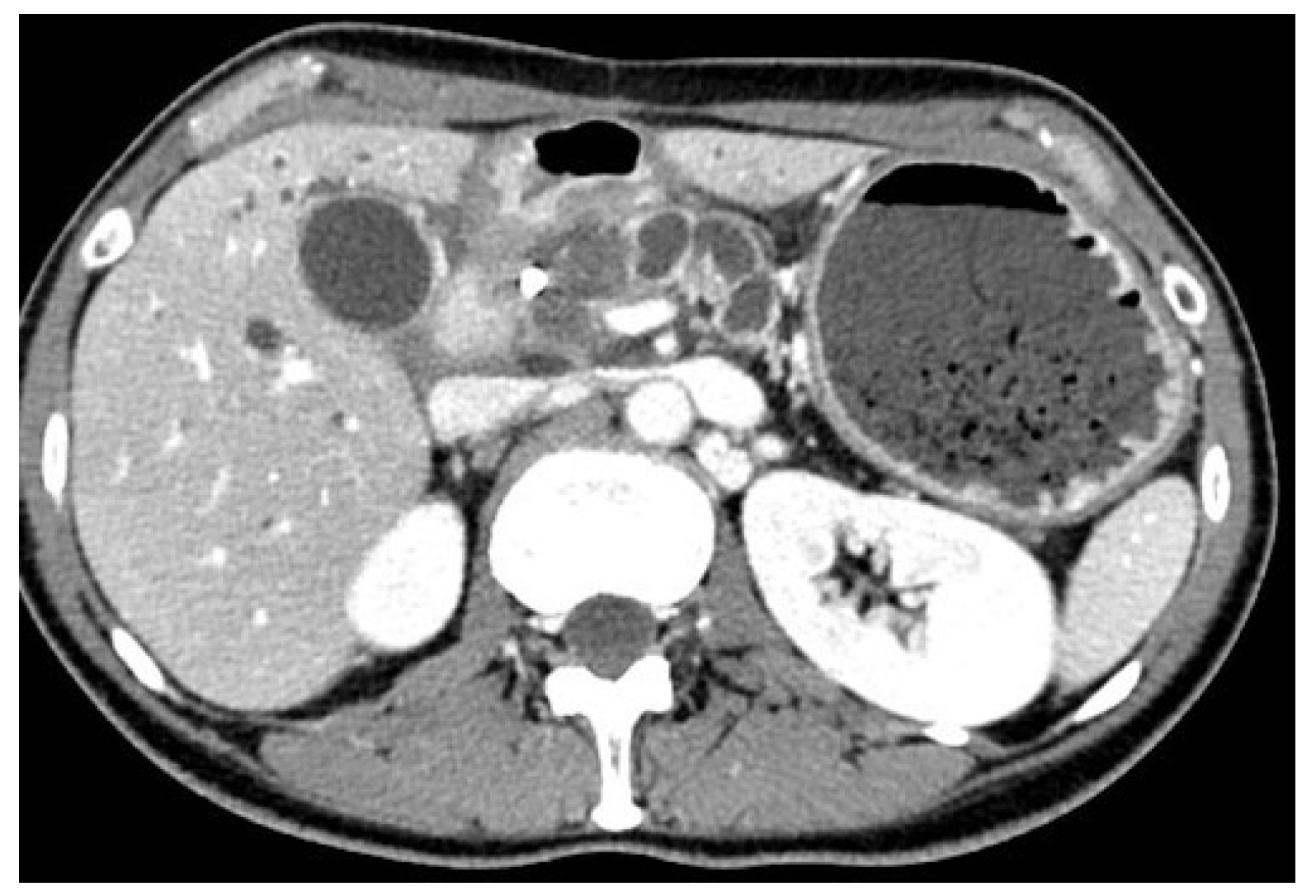 Medicina 60 00638 g003